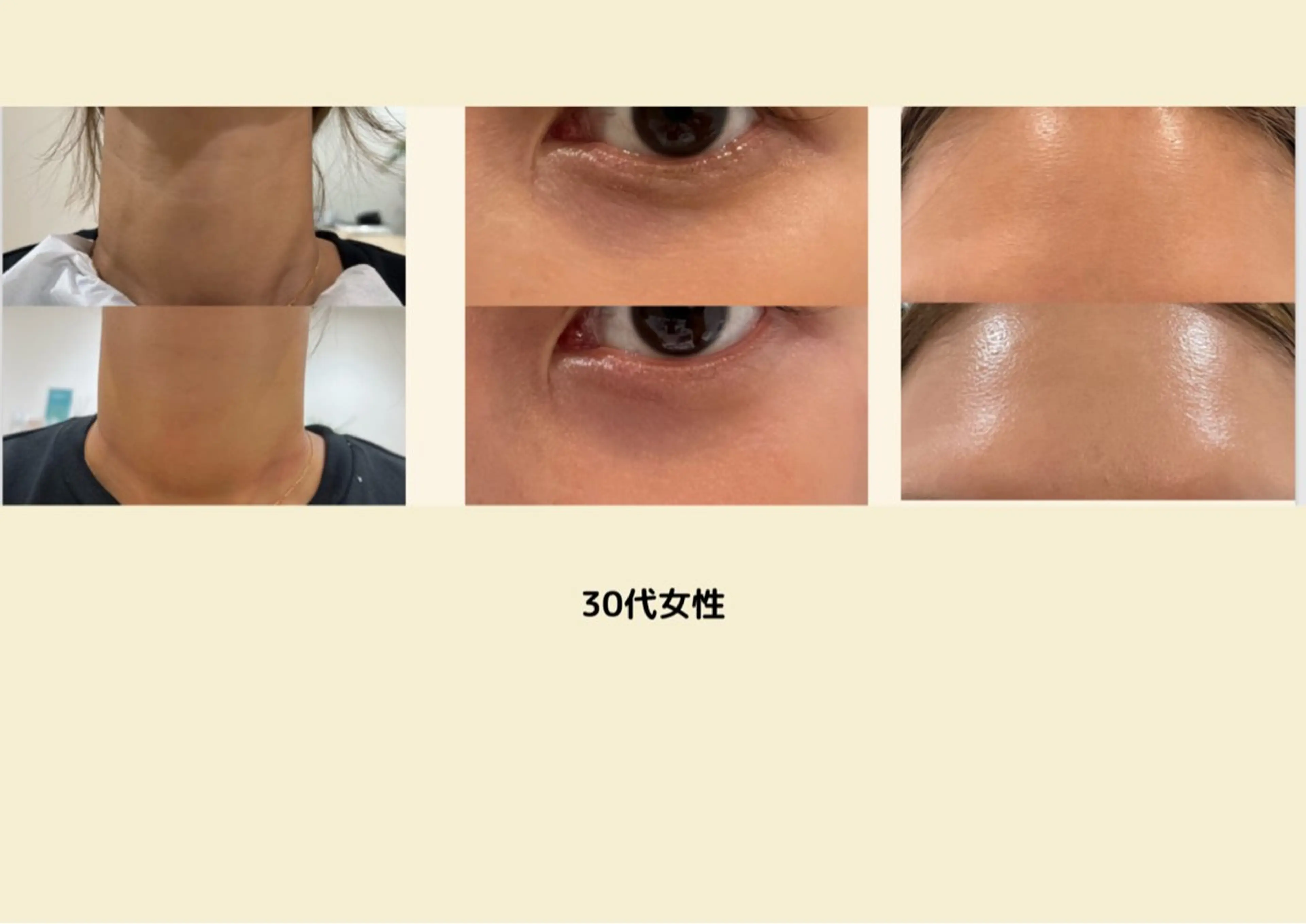 エステ 艶肌ワックス ALLY.のエステ・リラクイメージ