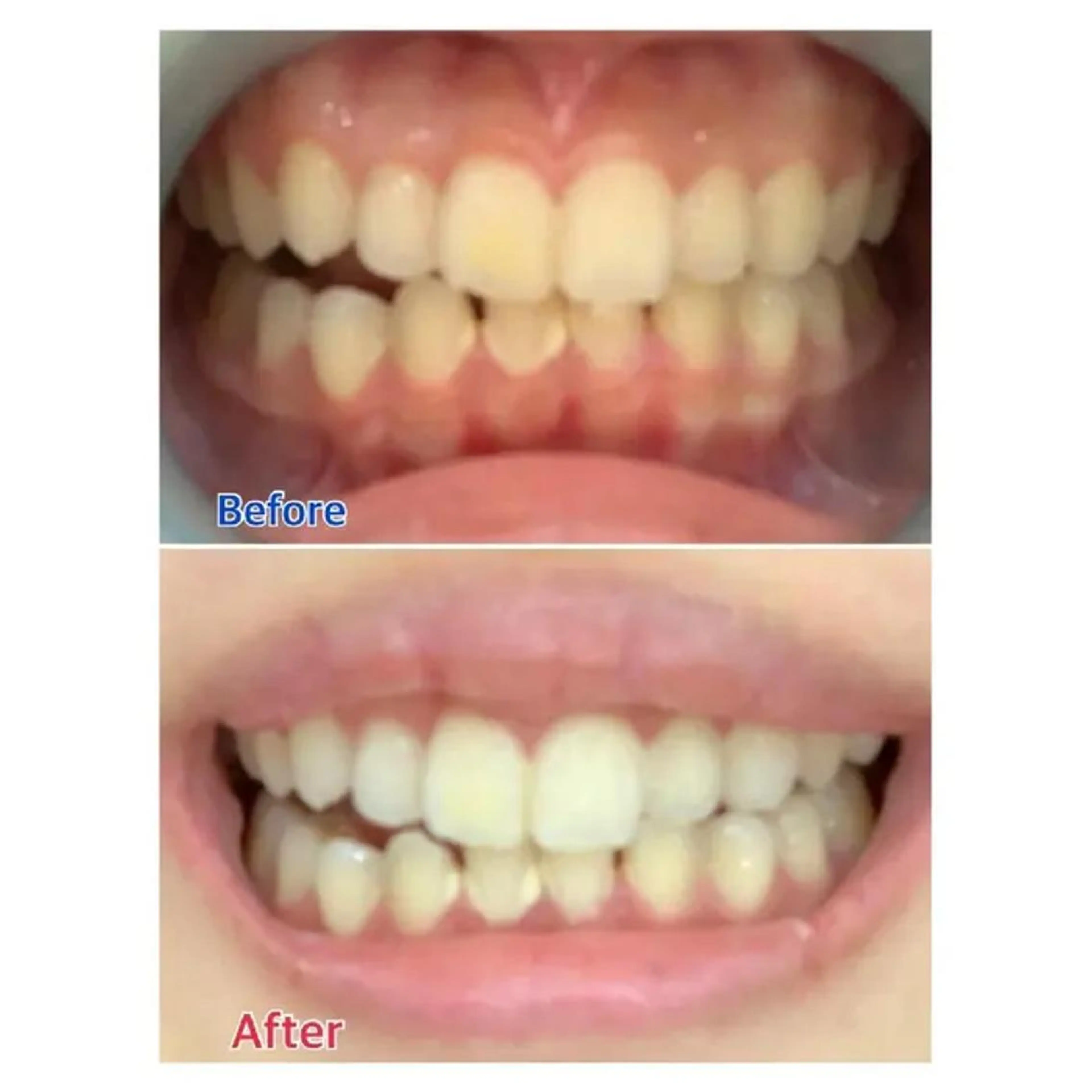 M渋谷 ホワイトニングのエステ・リラクイメージ