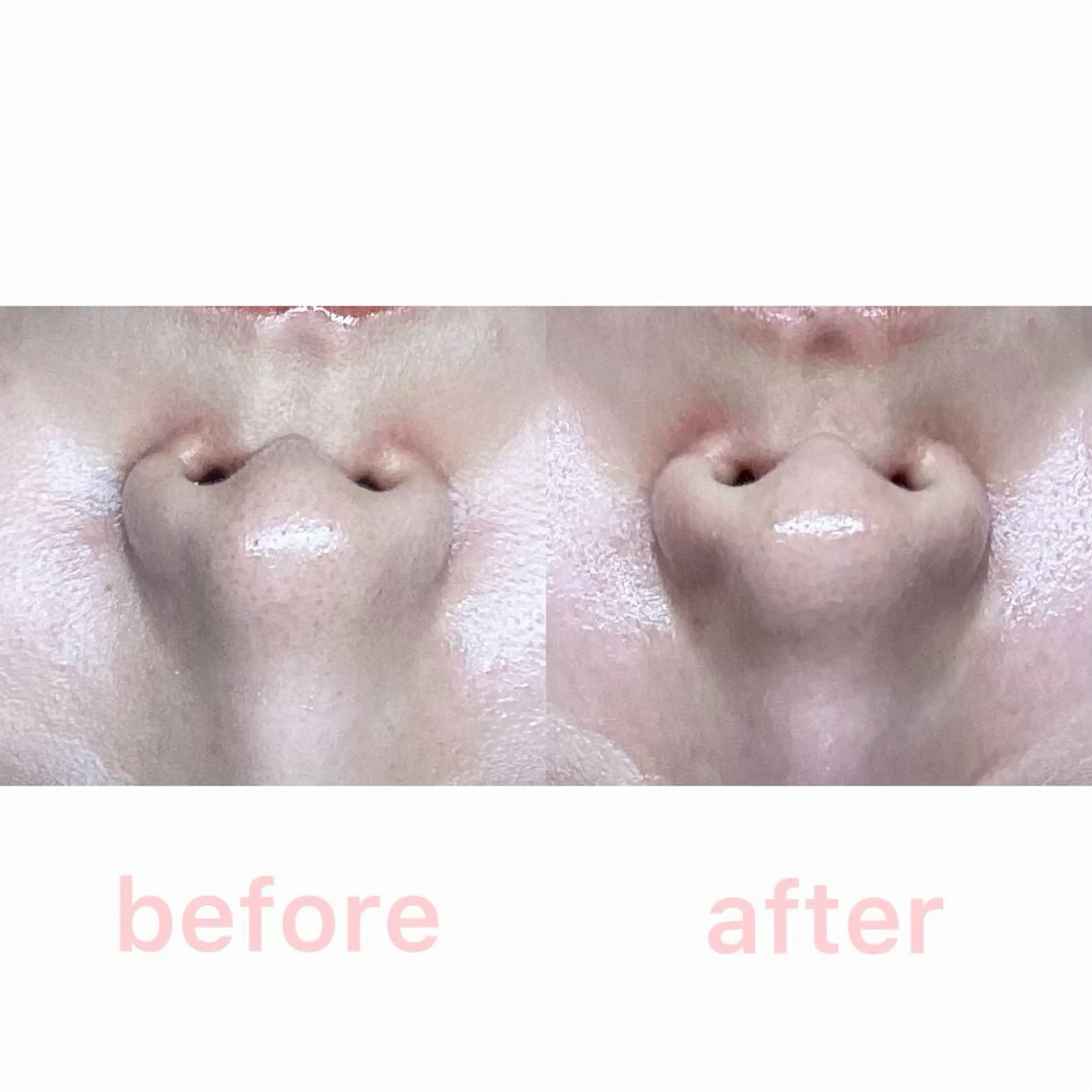 Rifuro 勝田台エステ所属・Rifuro勝田台 ララピール・毛穴洗浄のエステ・リラクイメージ