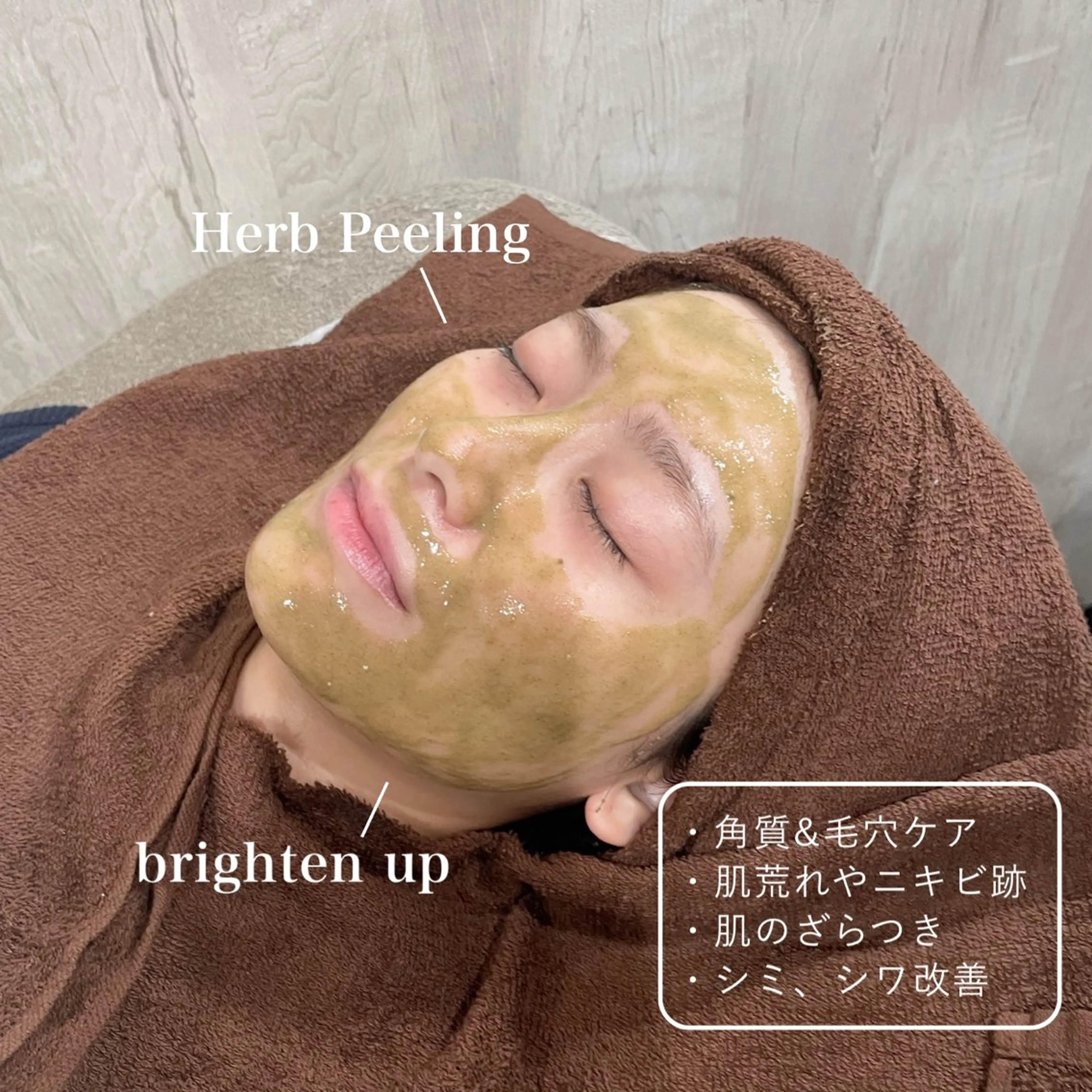 ミニモ限定　特別価格✨ ハーブピーリング 🌿ニキビケア＆毛穴改善の写真