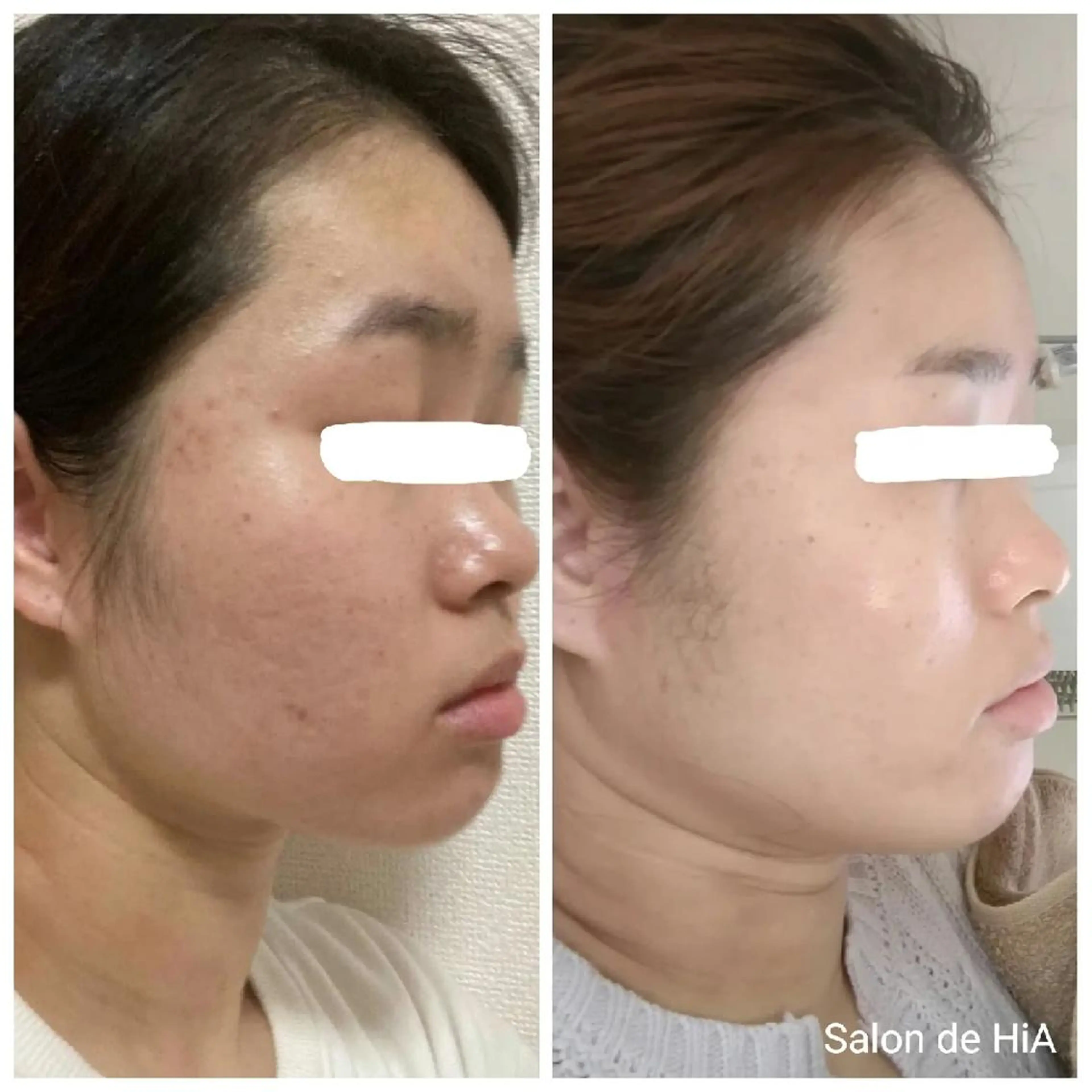 エステ Salon de  HiAのエステ・リラクイメージ