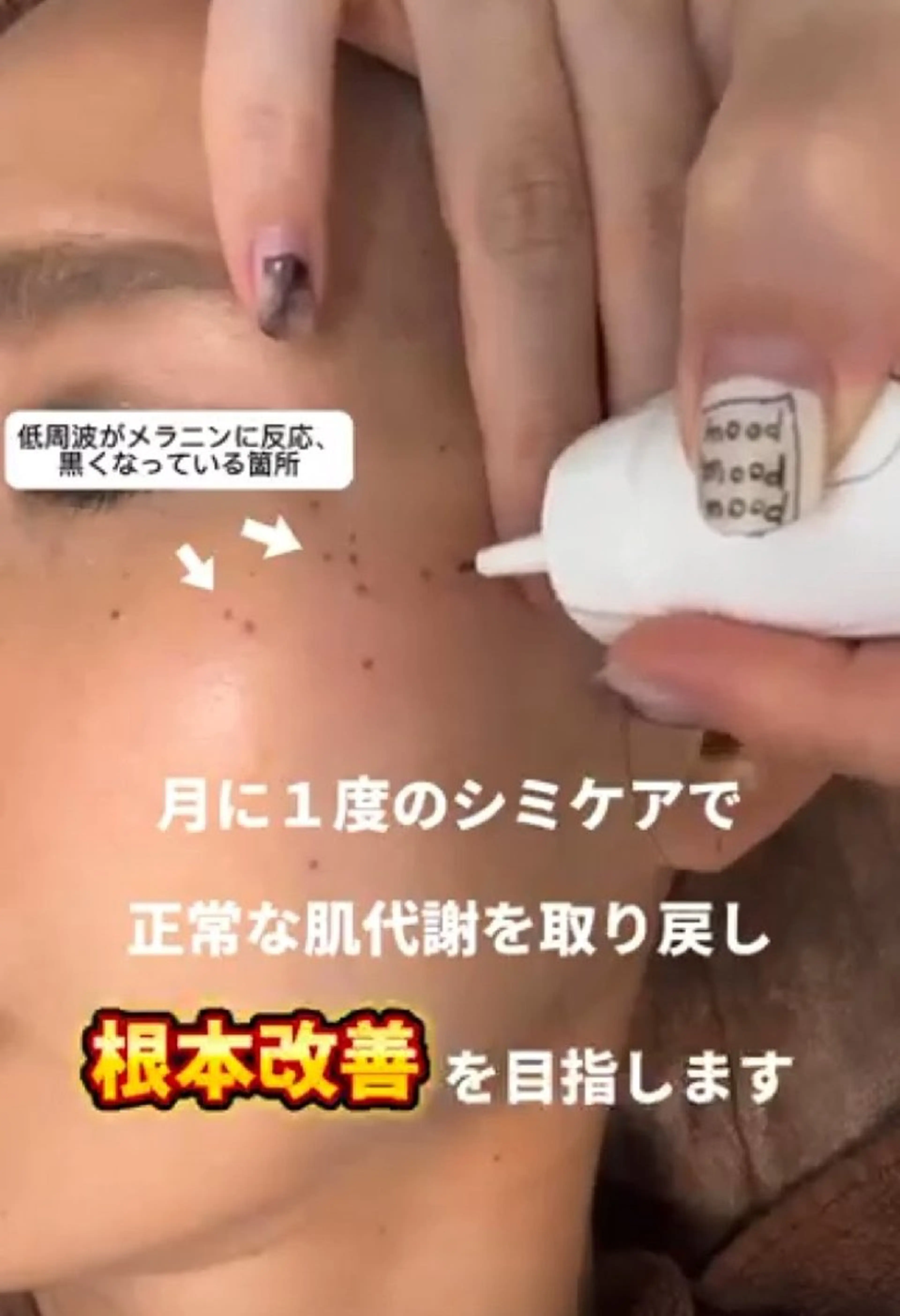 SPOT.com  シミケア専門店のエステ・リラクイメージ