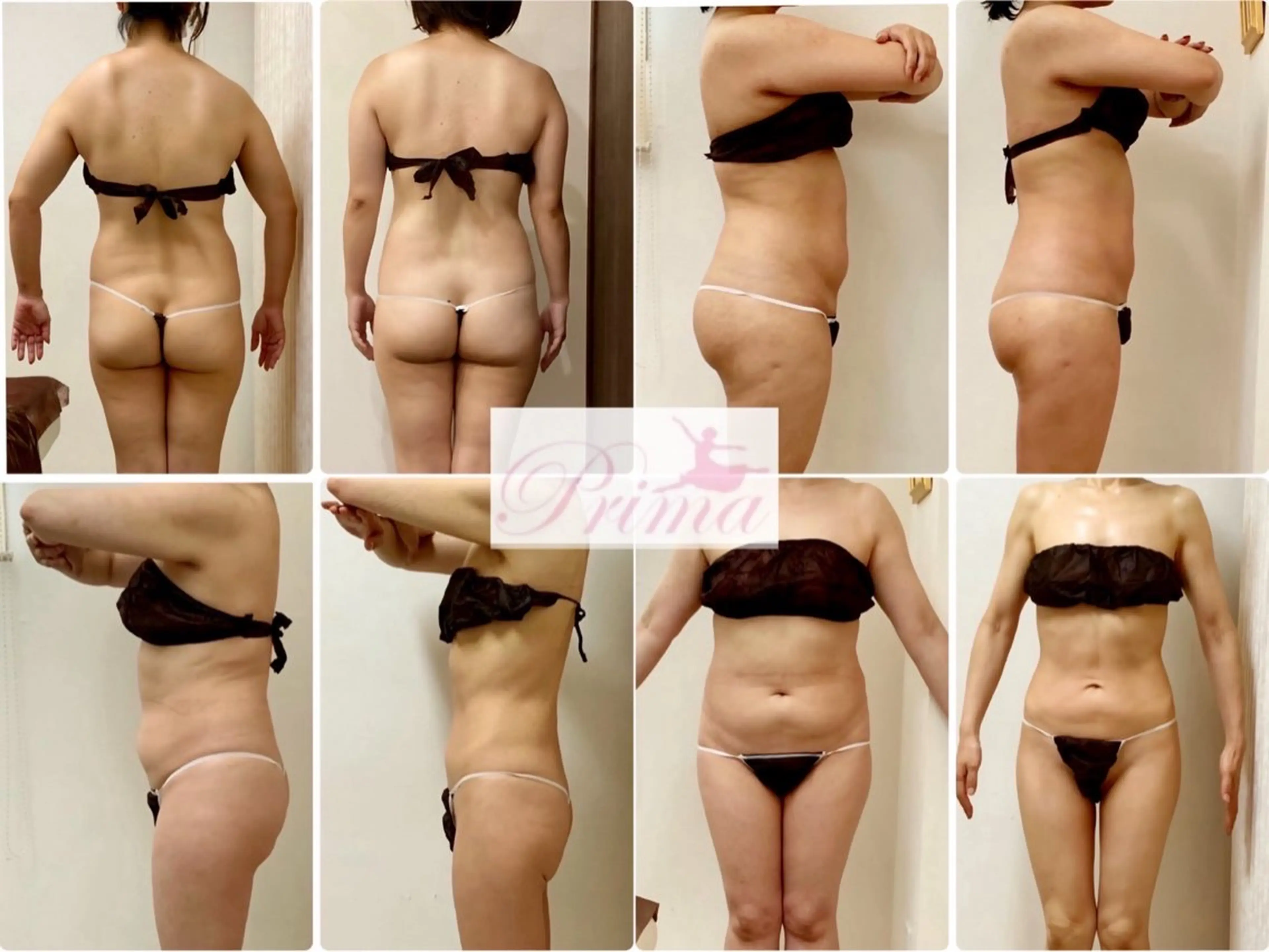 エステ リラク Prima 痩身脱毛 にごうかおりのエステ・リラクイメージ