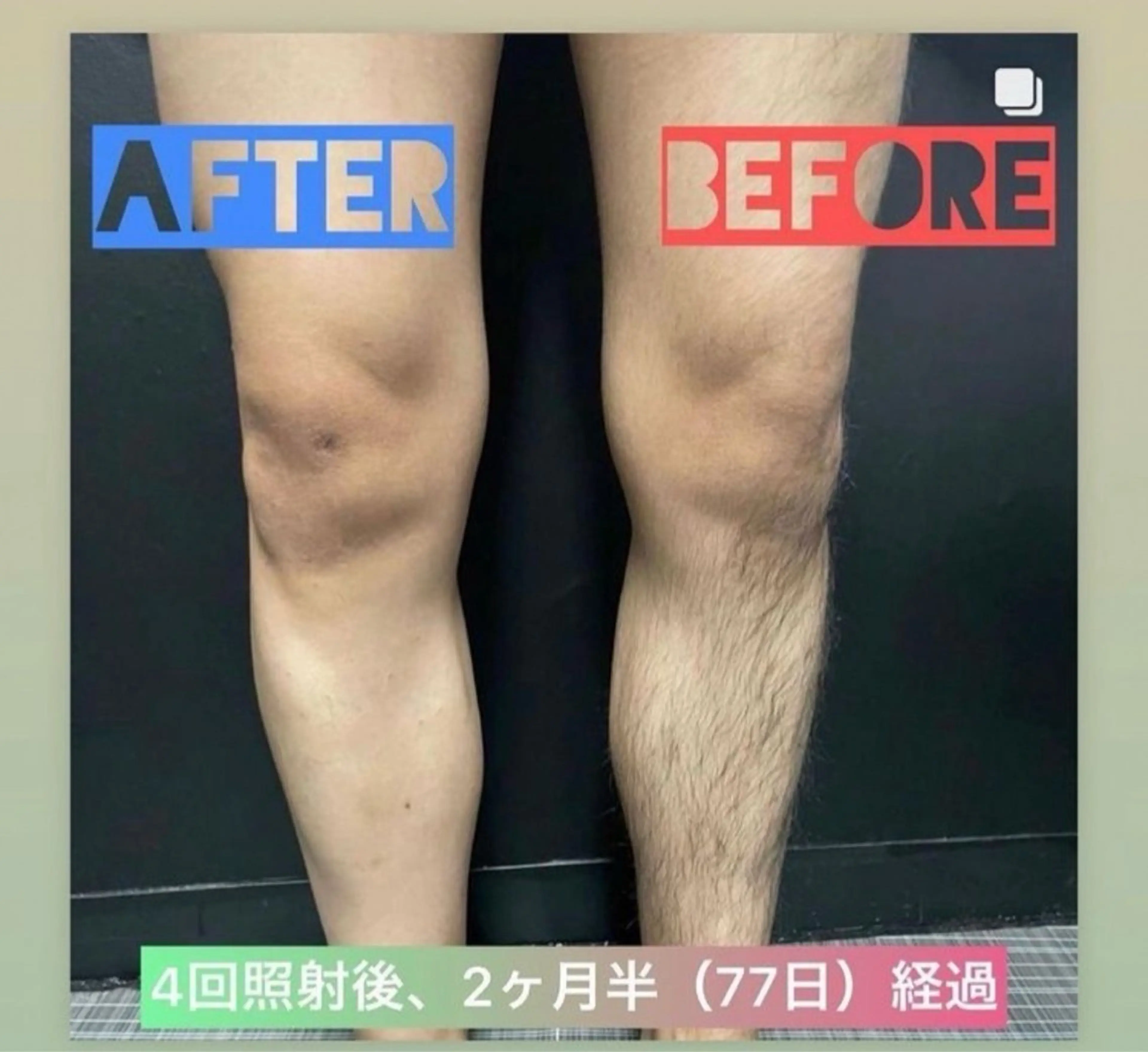 メンズ 脱毛 Neosalon ネオサロンのエステ・リラクイメージ