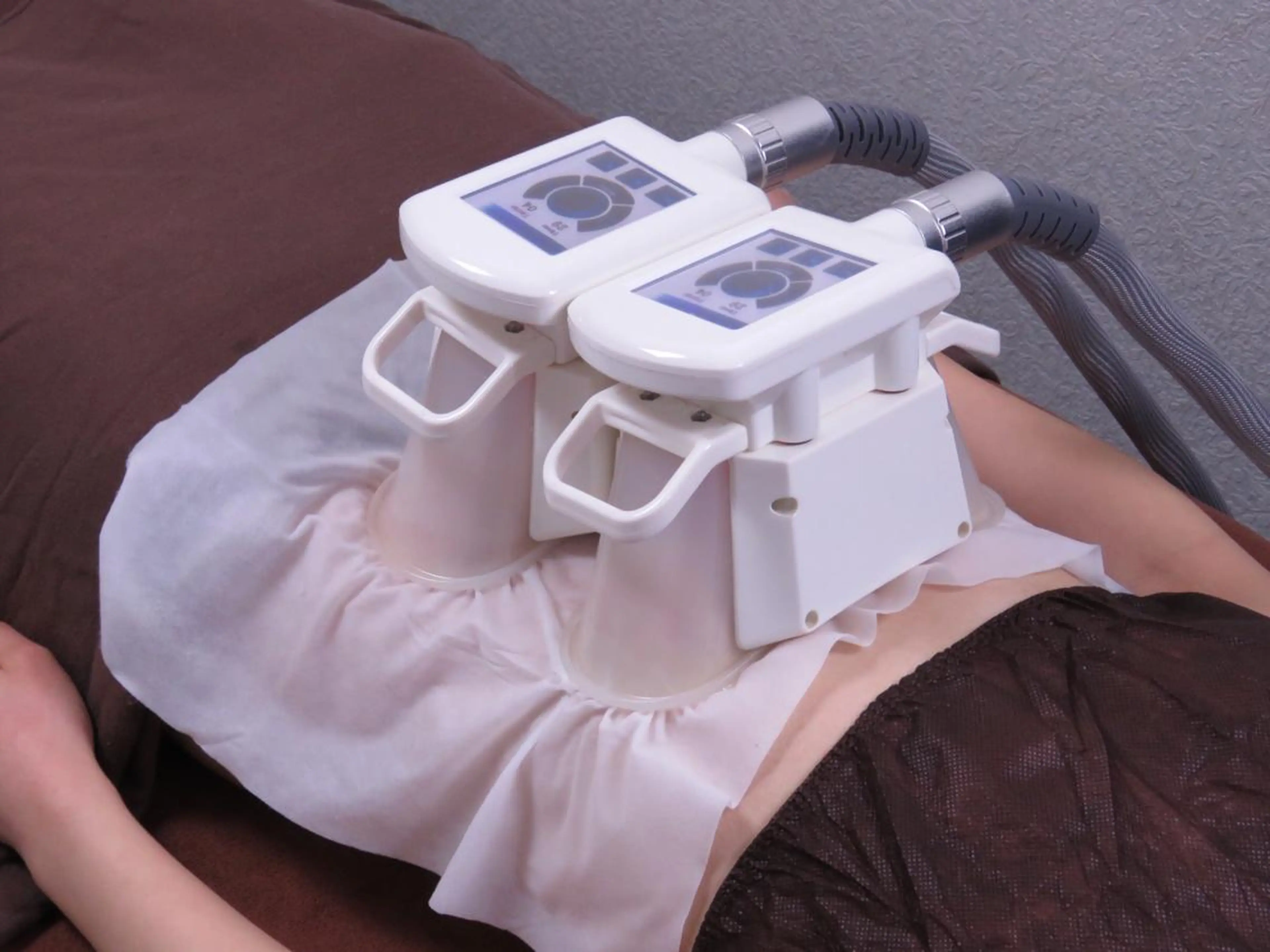 人気No.3脂肪瘦身2部位(大カップ式2部位orパッド式2部位)¥7800の写真