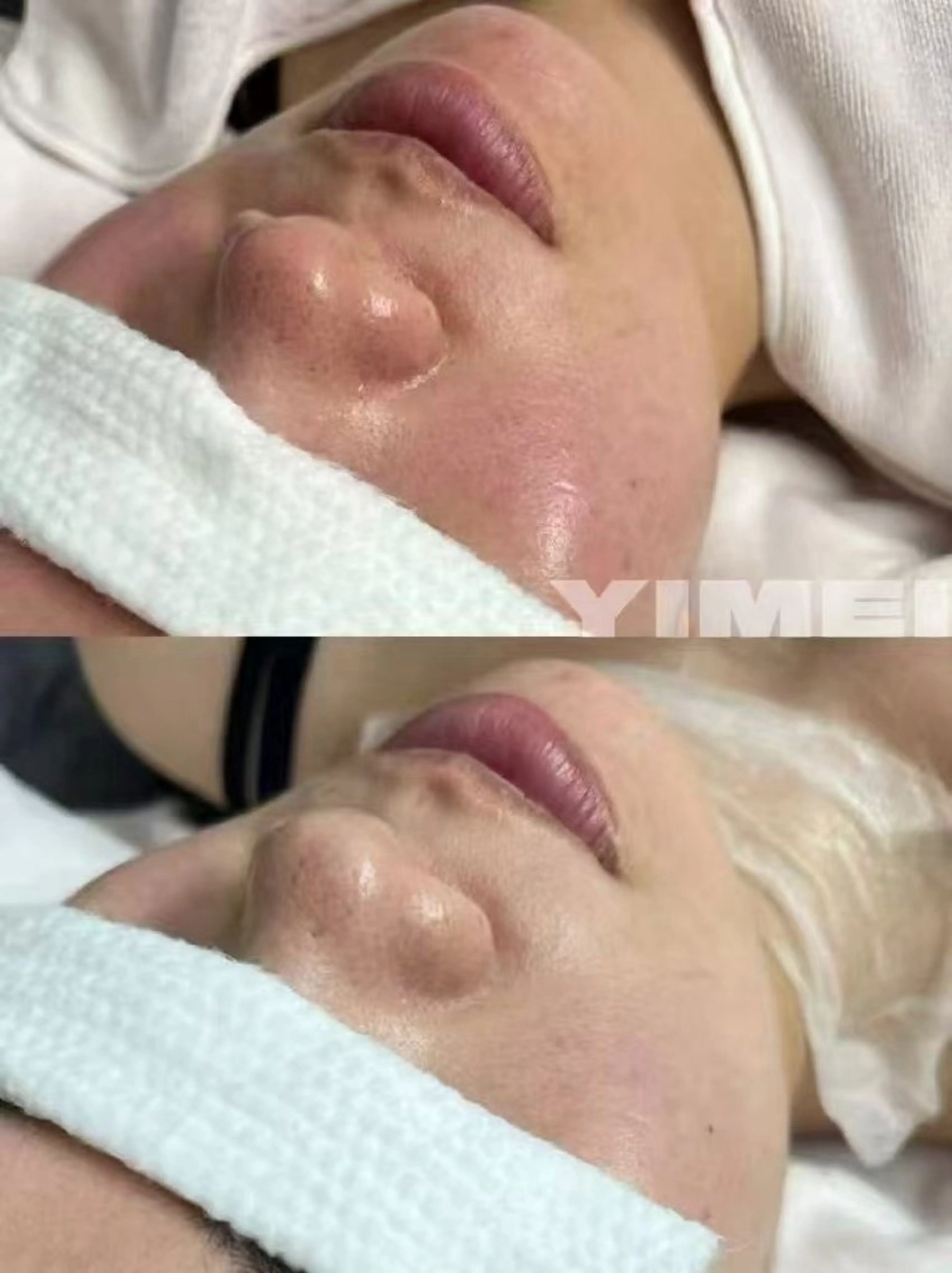 マツエク・マツパ エステ aliaハイフ&水光ジェットサロン所属・aliaハーブ水光店 エステティシャン募集のエステ・リラクイメージ