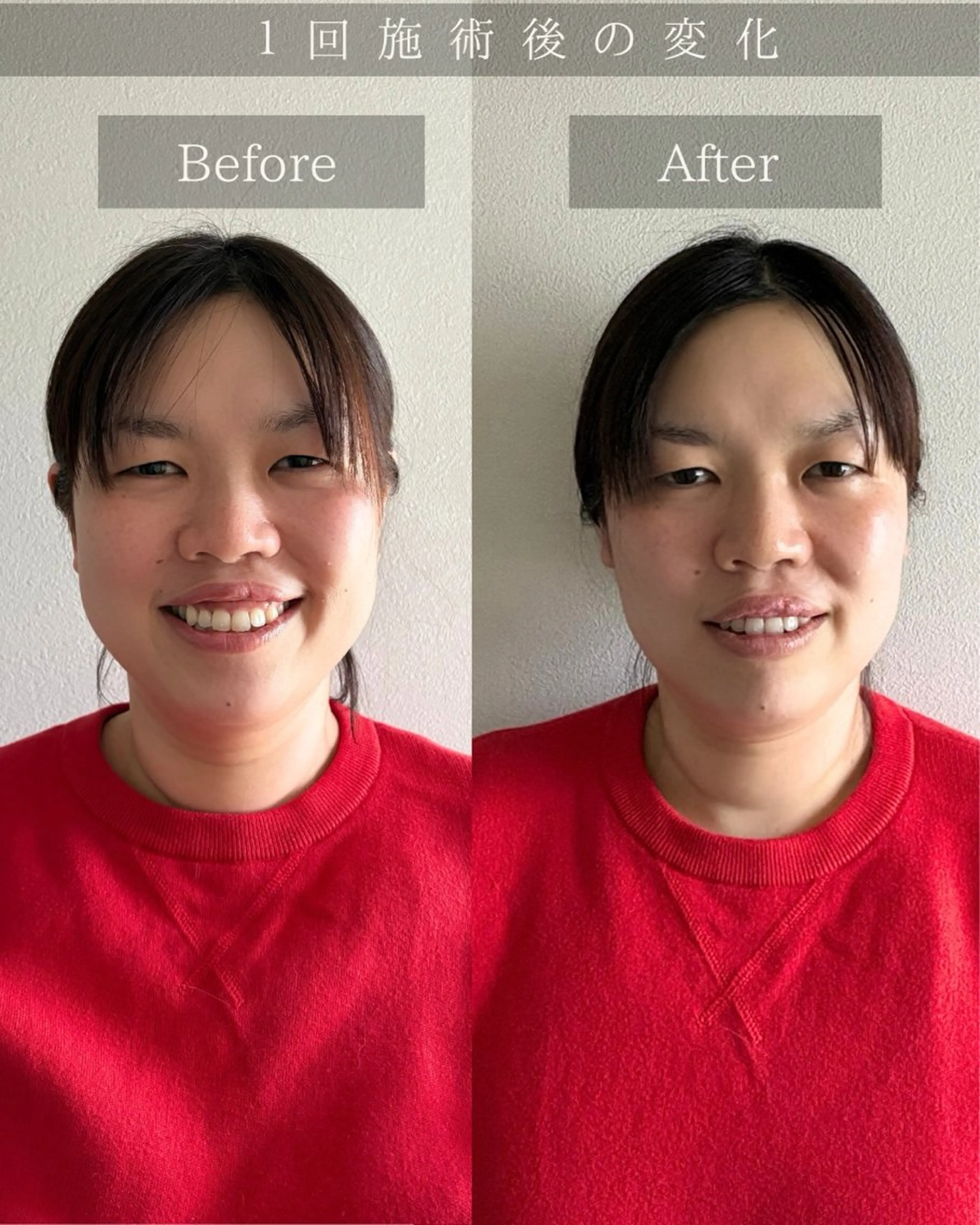 美肌&小顔矯正 Noelieのエステ・リラクイメージ