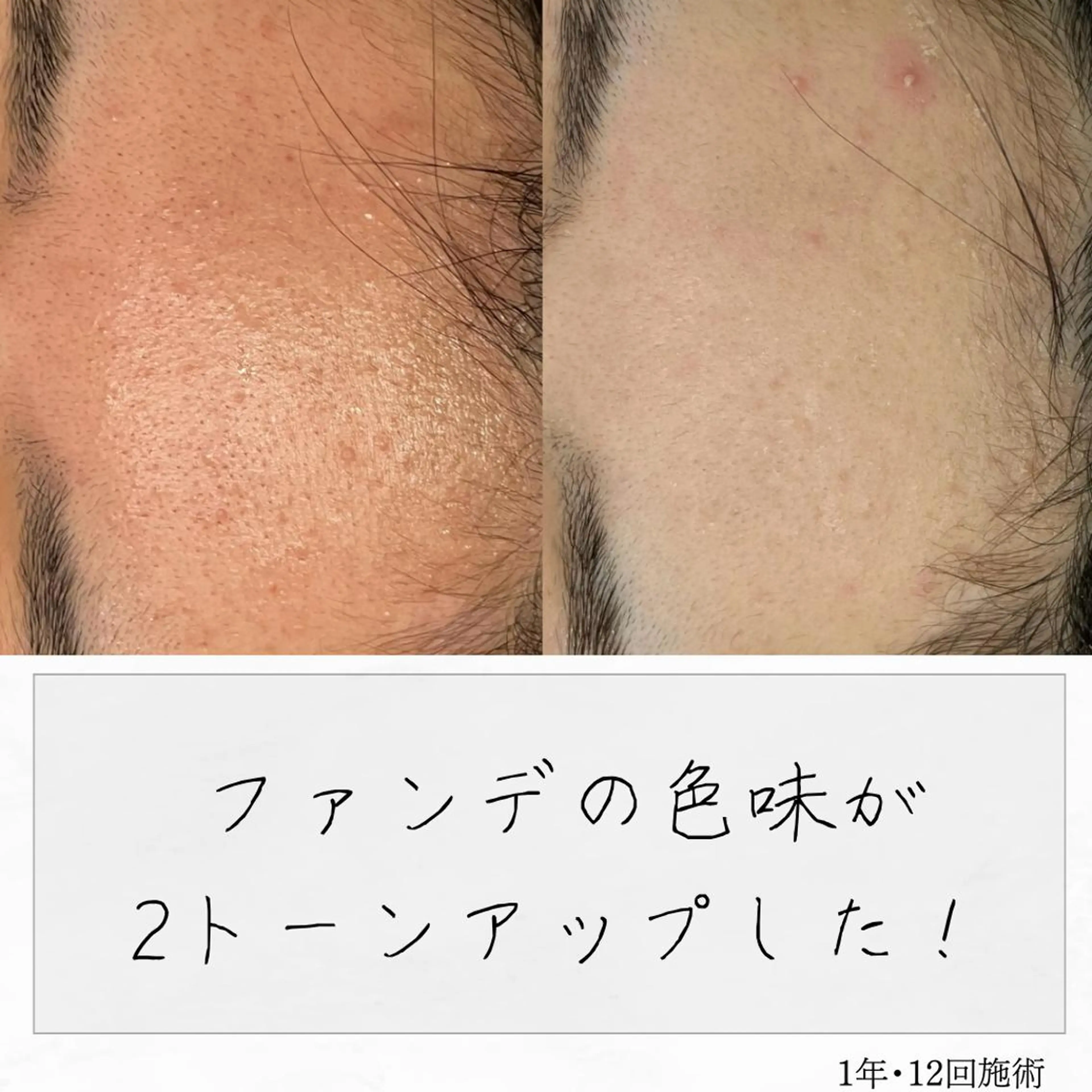 ニキビ経験者が施術 する専門サロン🌻のエステ・リラクイメージ