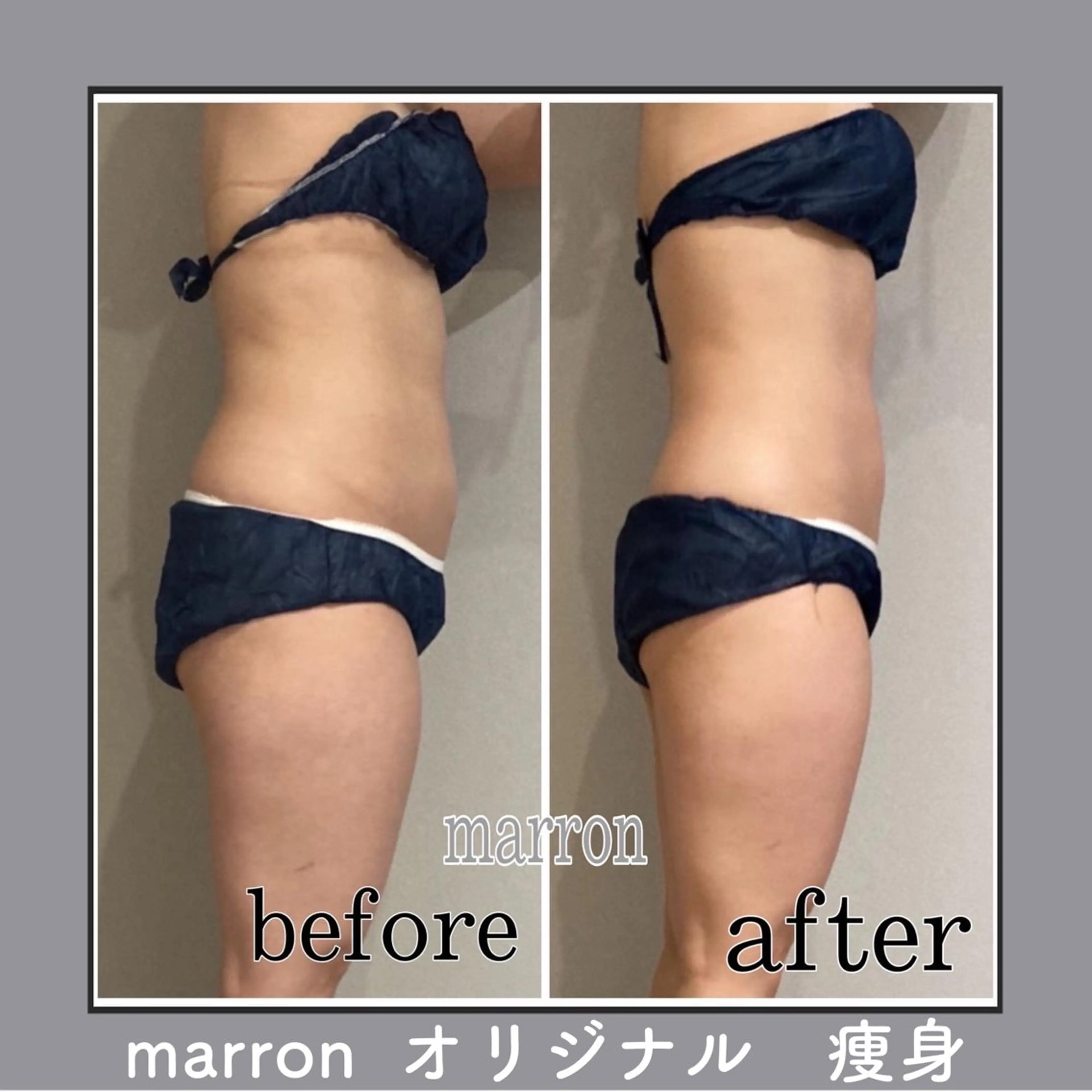 marron所属・痩身ハイパーナイフ ララピールリアボーテのエステ・リラクイメージ