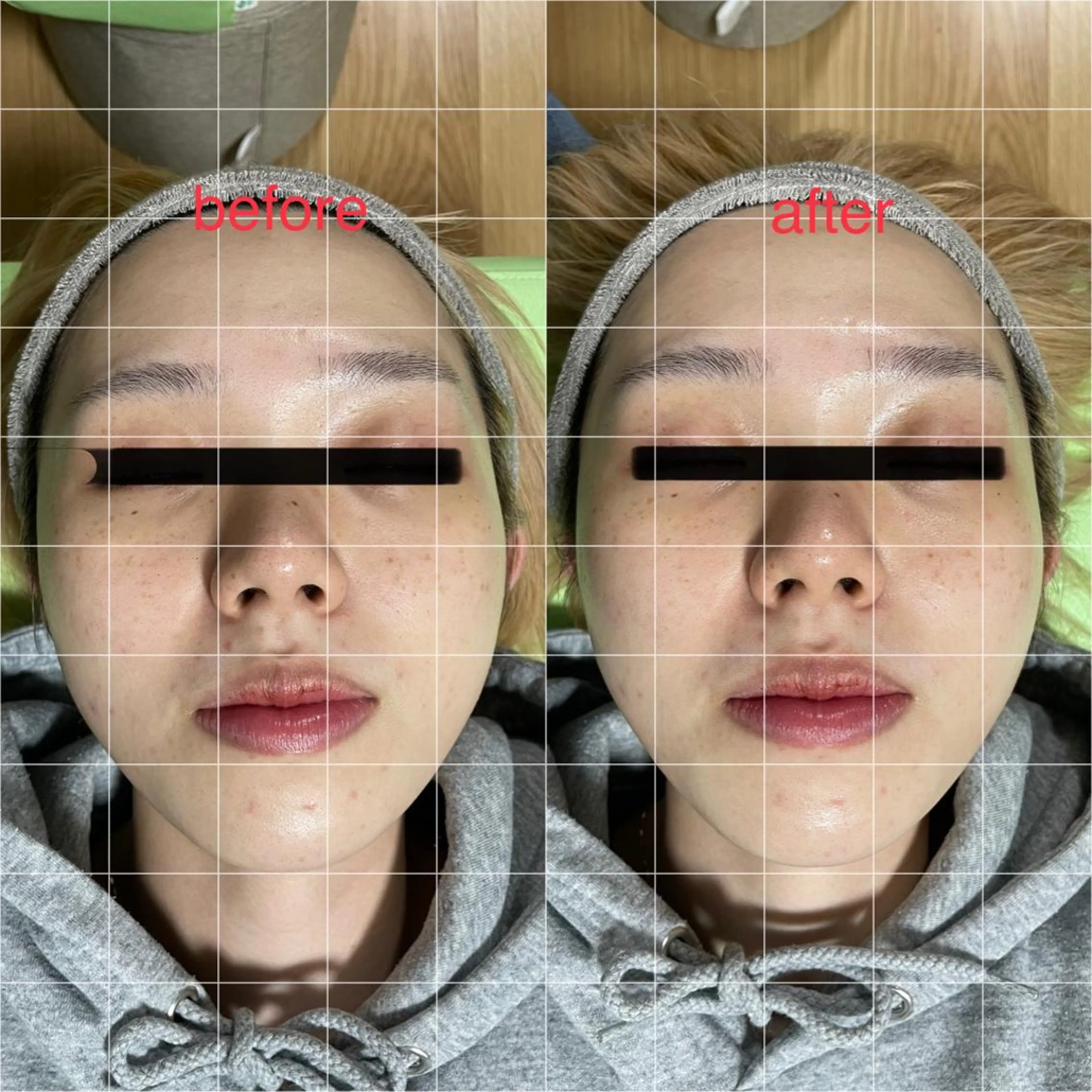 蓮花鍼灸 整骨院のエステ・リラクイメージ