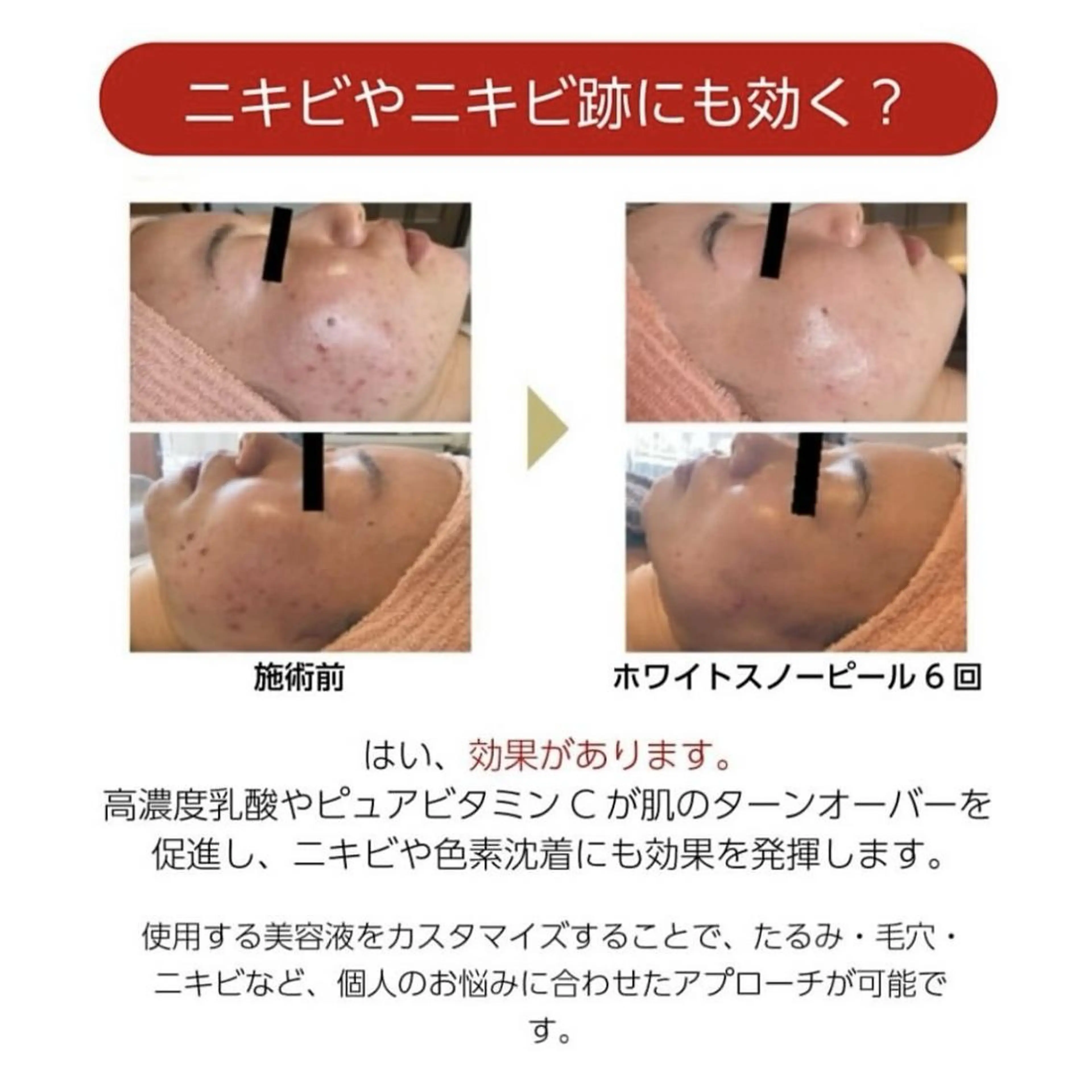 RinRin 山口店のエステ・リラクイメージ