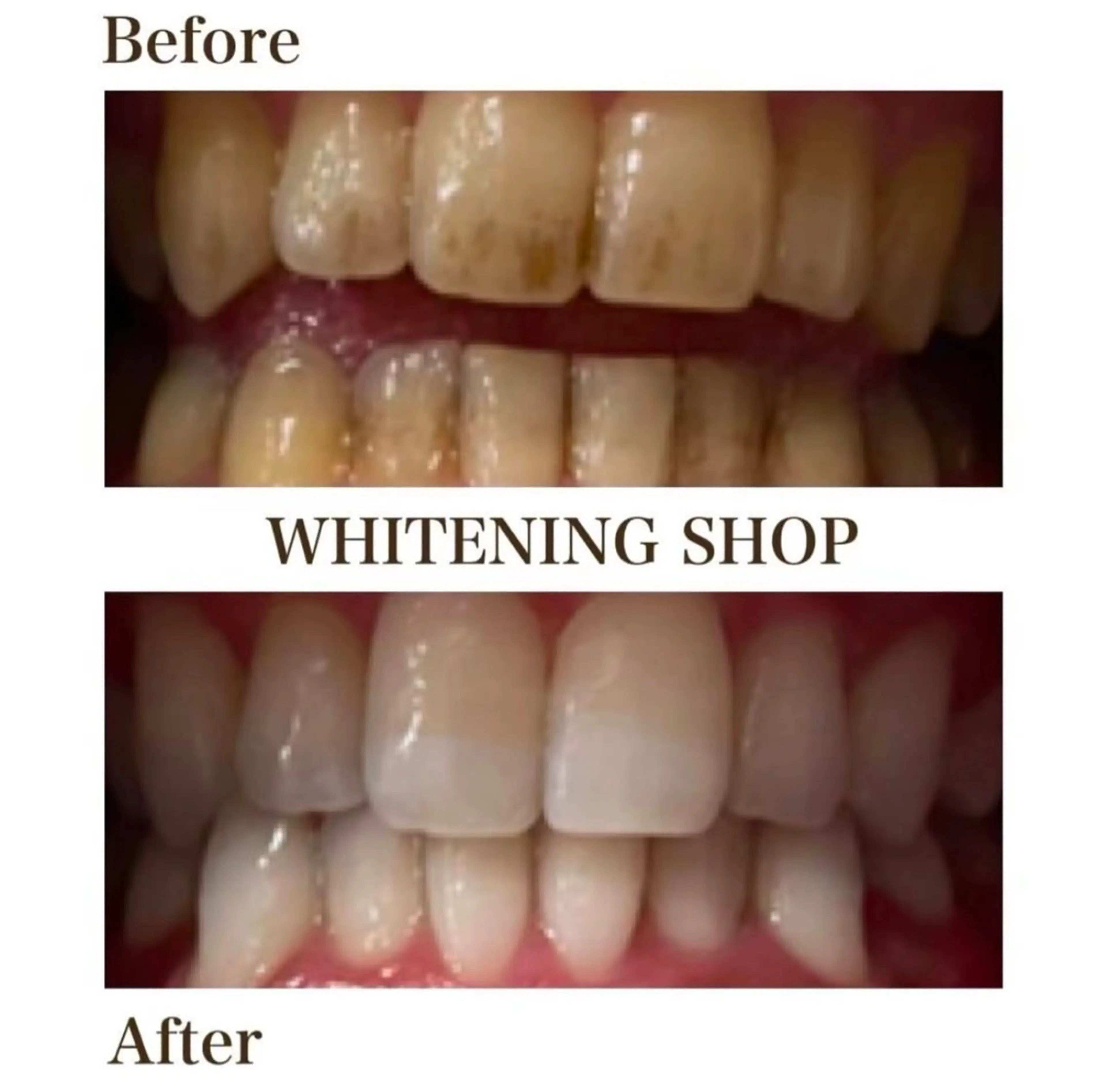 ホワイトニング ショップ伊丹店のその他イメージ