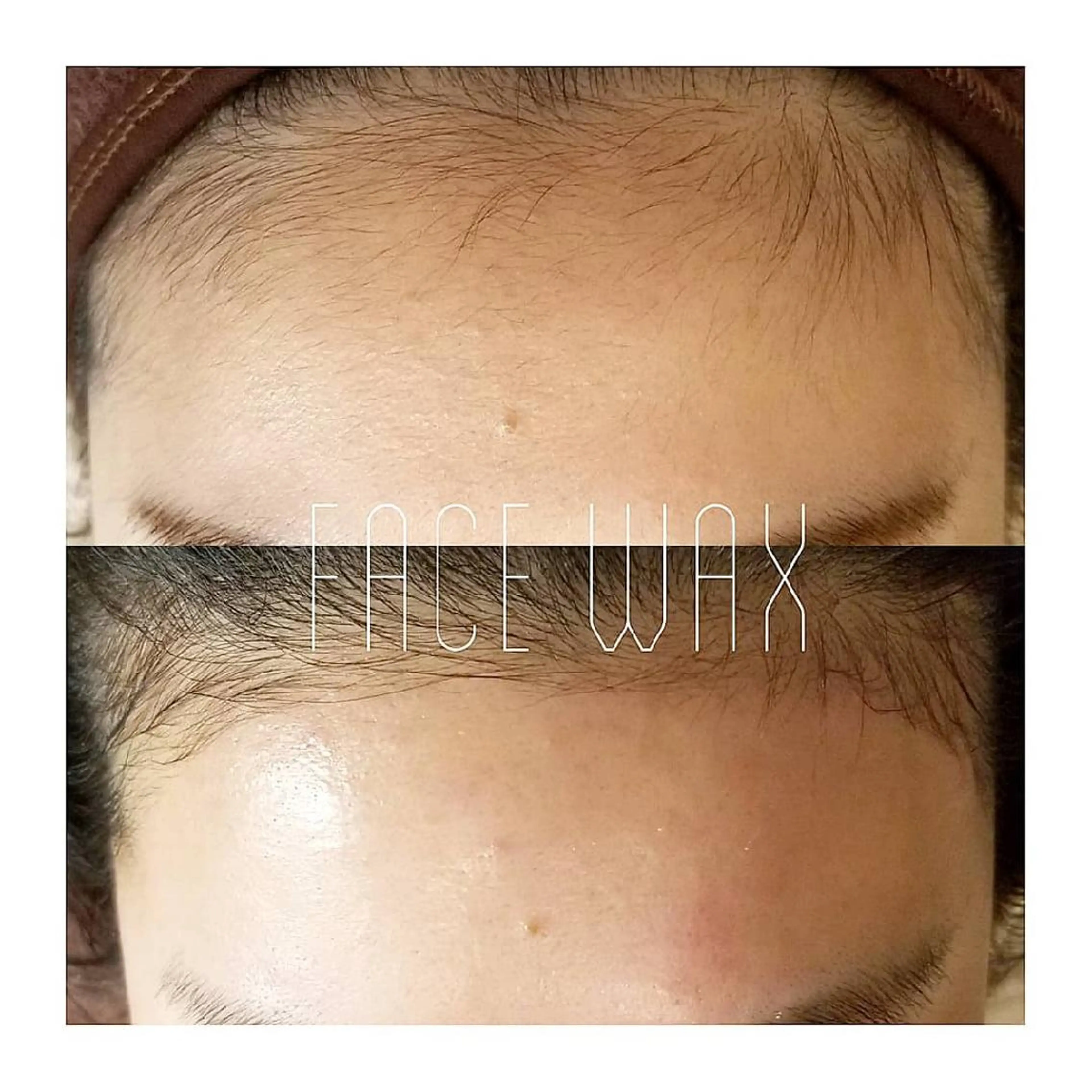 初回>>【お顔の産毛脱毛】フェイシャルワックス脱毛【ツルツル美肌】の写真