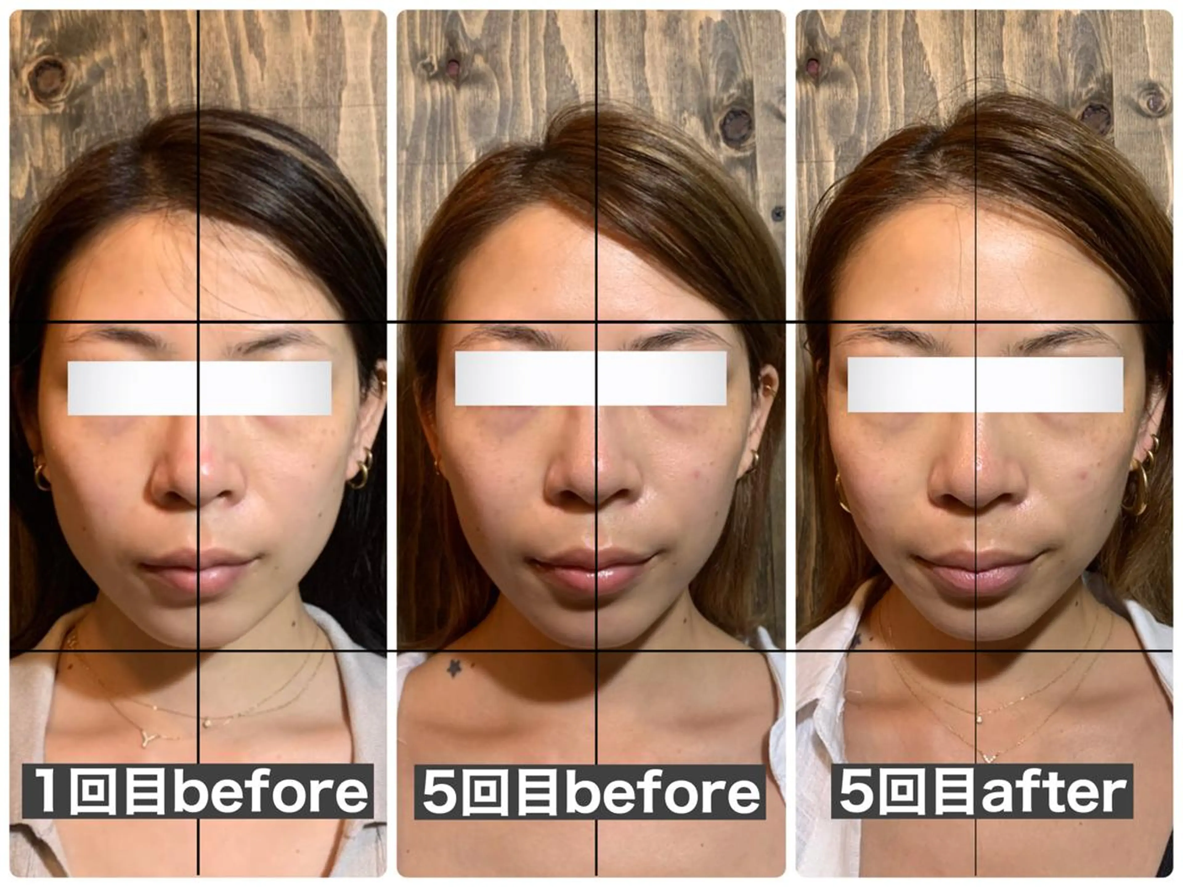 エステ リラク 💎後悔させない小顔 矯正💎イトヤマ🌱のエステ・リラクイメージ