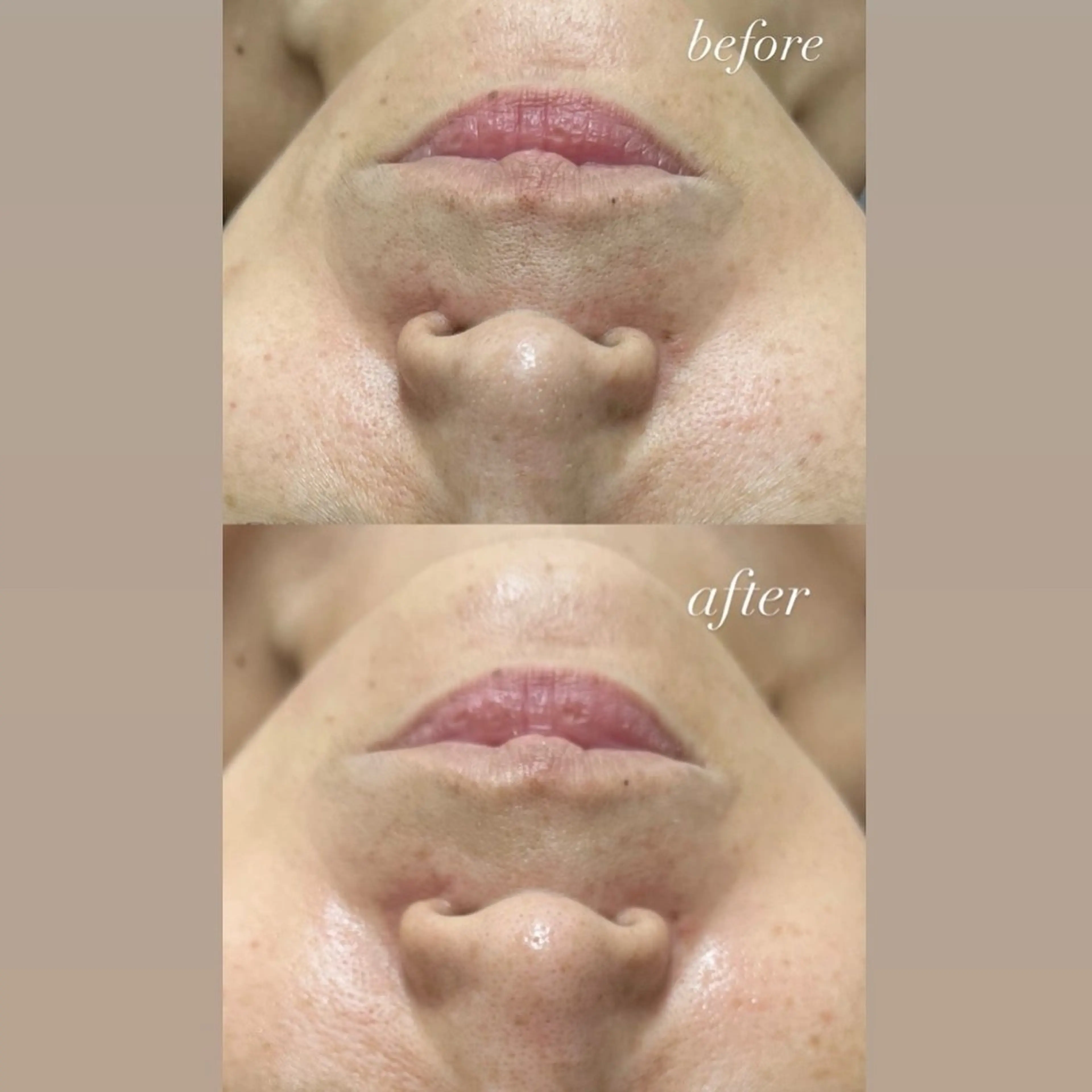 その他 smileskin 京都／meguのその他イメージ