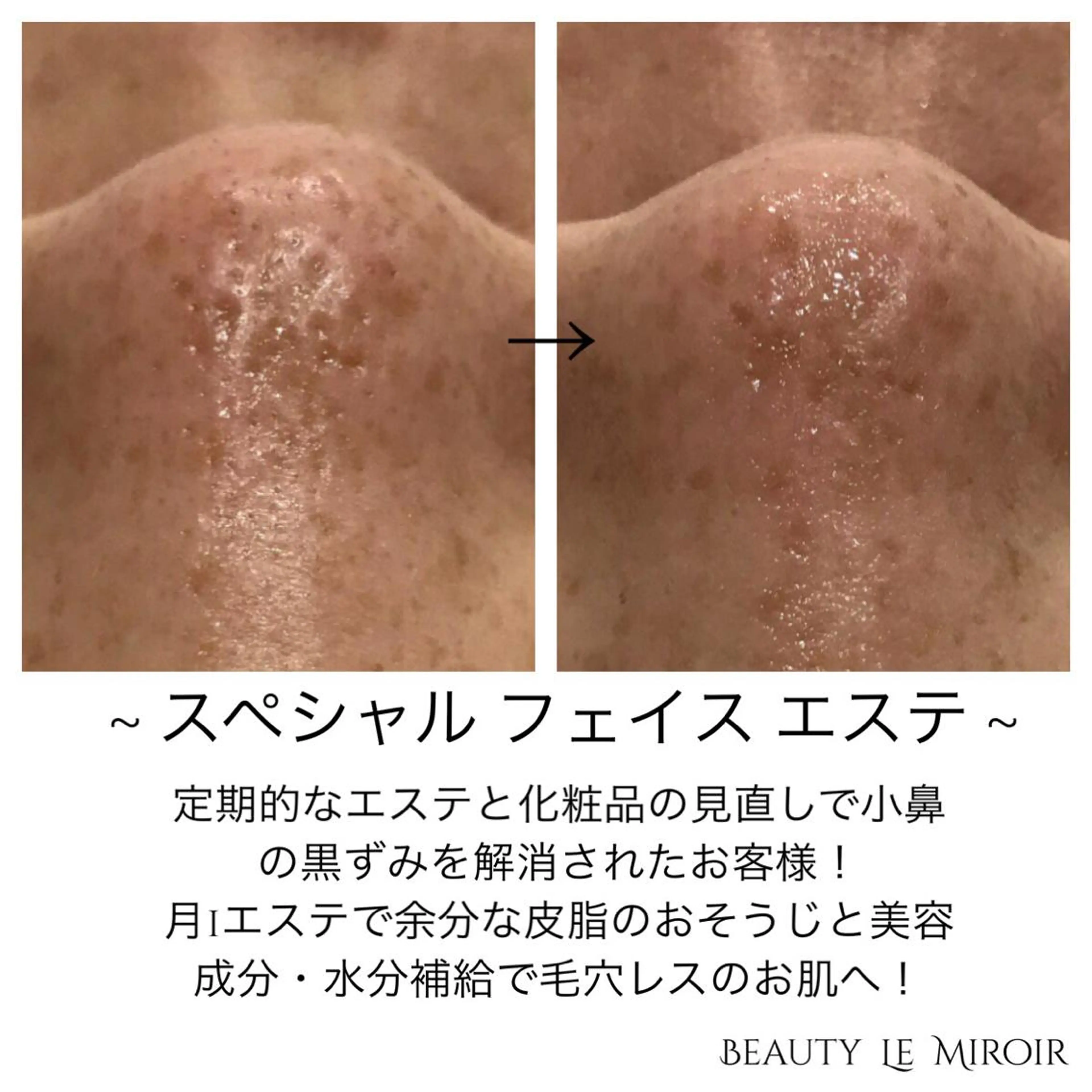 ビューティー ミロワールのエステ・リラクイメージ