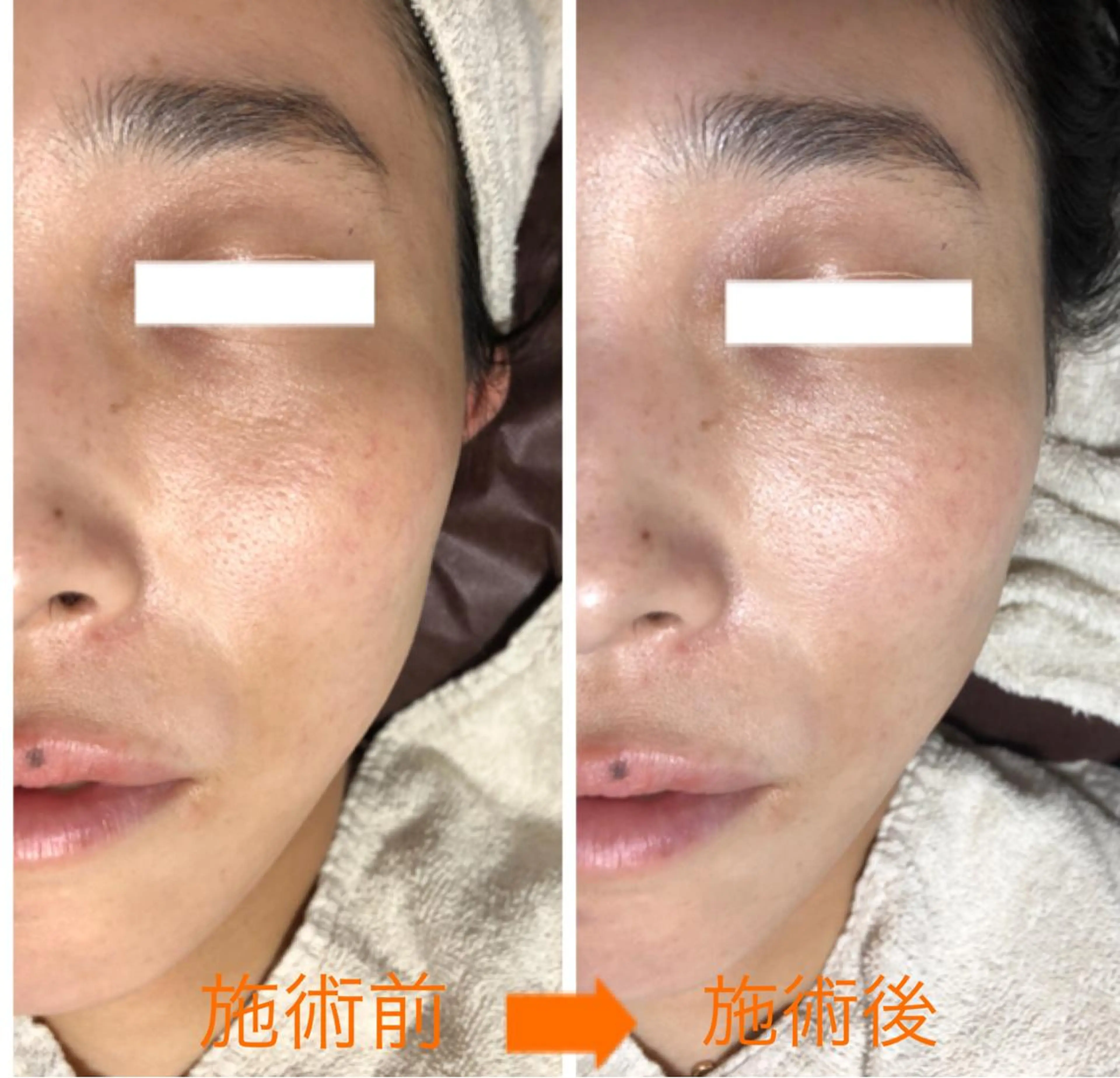 小顔・毛穴・たるみ ネイル　似内真樹のエステ・リラクイメージ