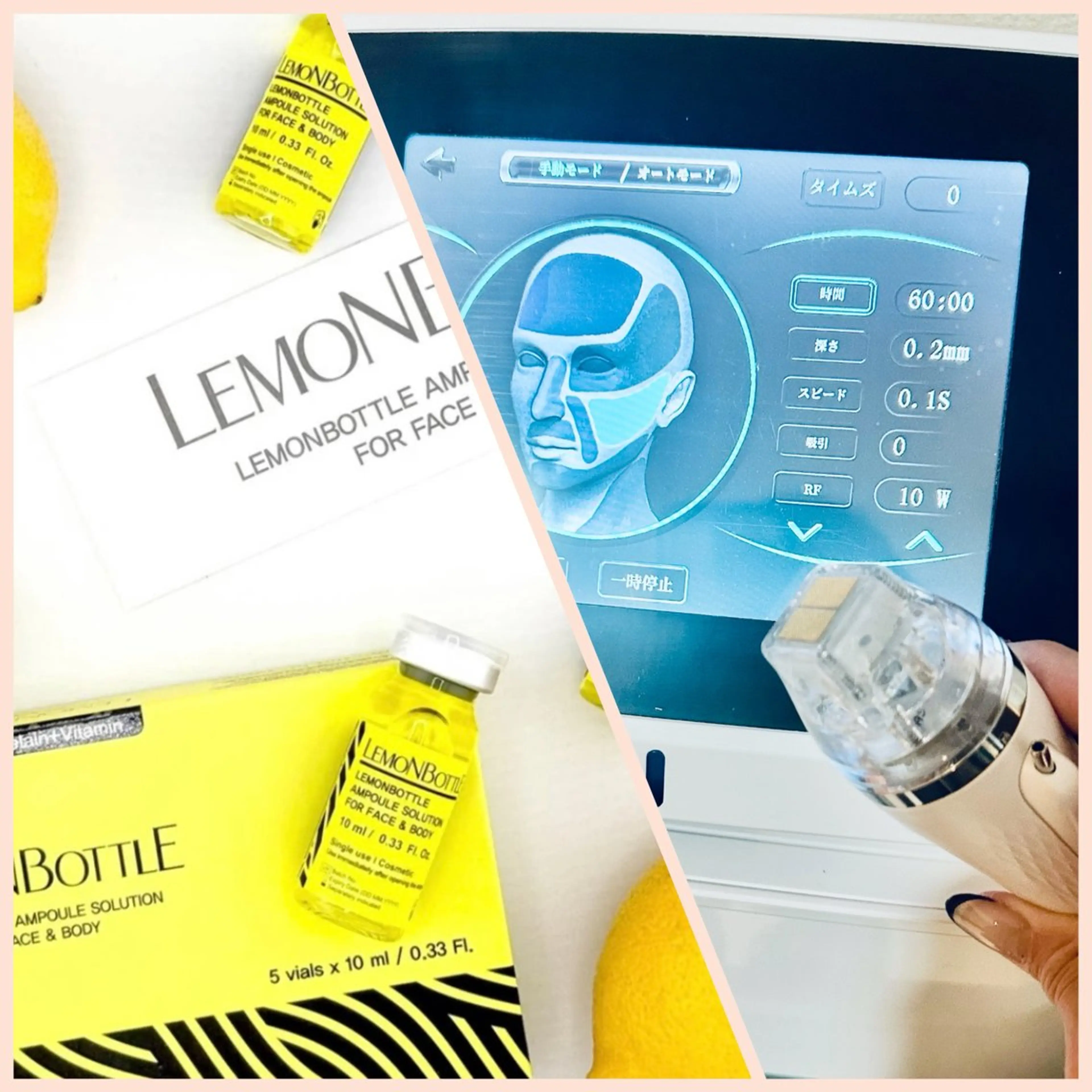 ☆Face レモンスキンブースター（2ccまで）✖︎ポテンツァ小顔•たるみ撃退コース☆の写真