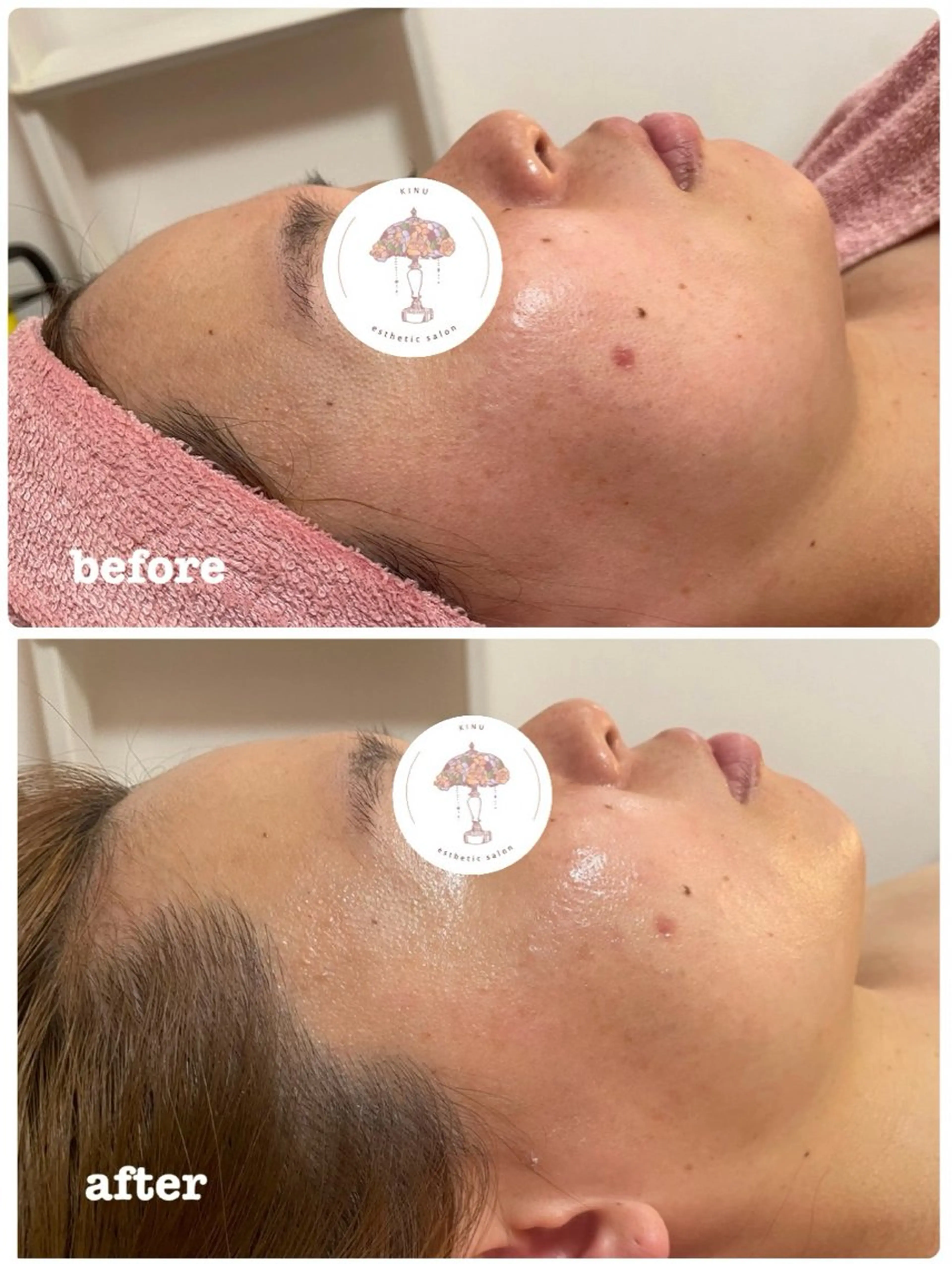 エステ 心満たされる ハーブピーリング絹々のエステ・リラクイメージ