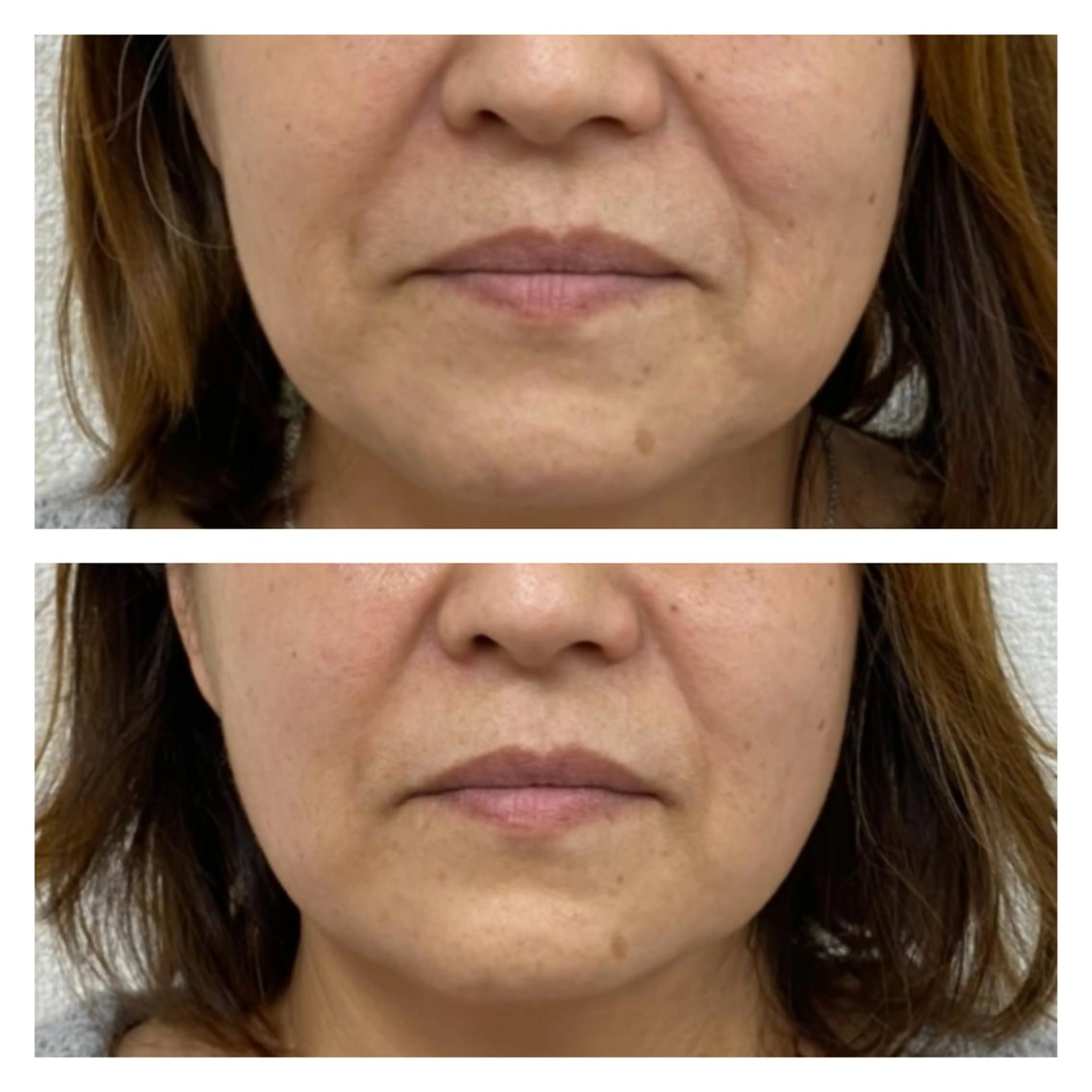 小顔矯正サロン Lilyのエステ・リラクイメージ