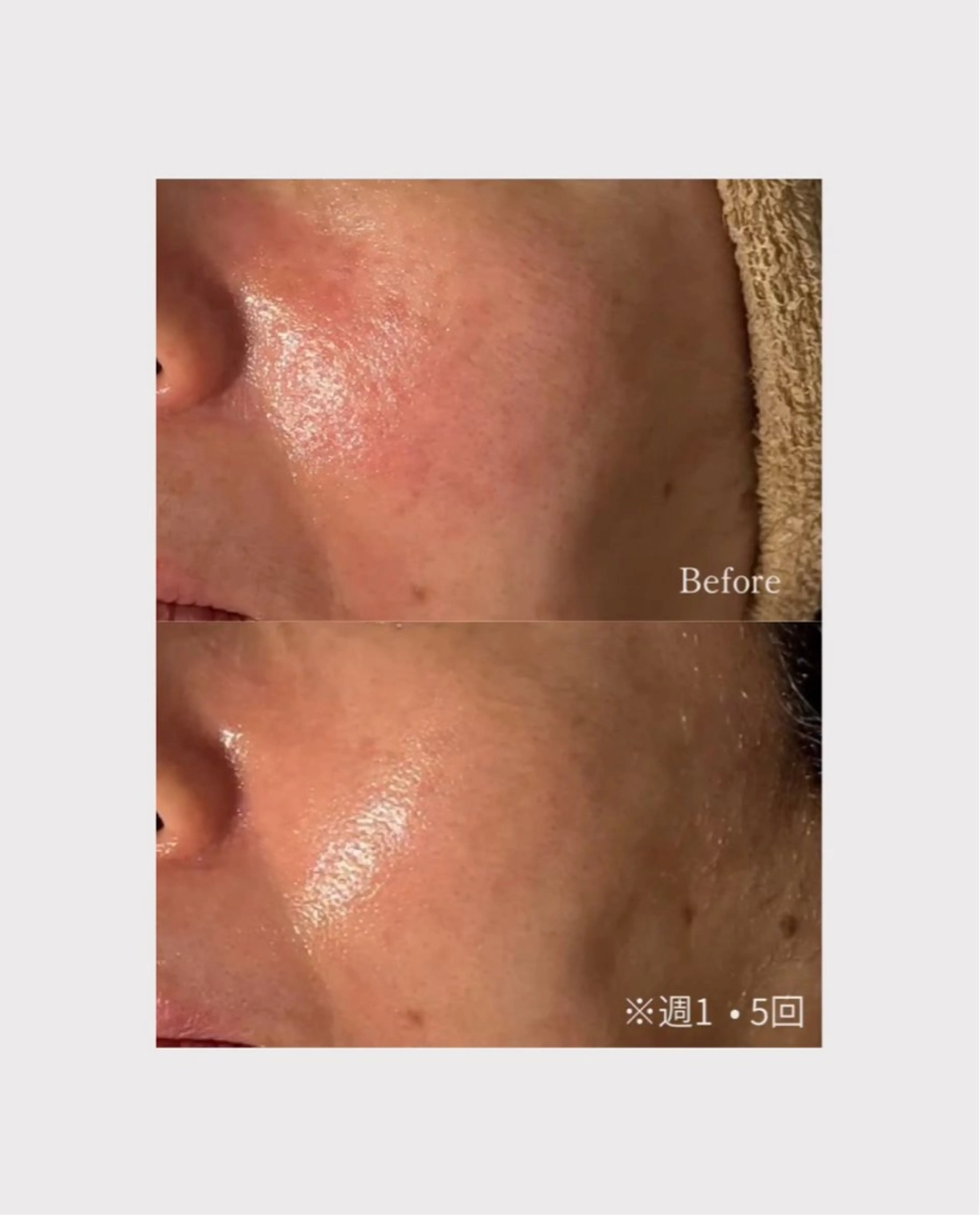 肌管理フェイシャル｜Utouto所属・肌管理フェイシャル Utoutoのエステ・リラクイメージ