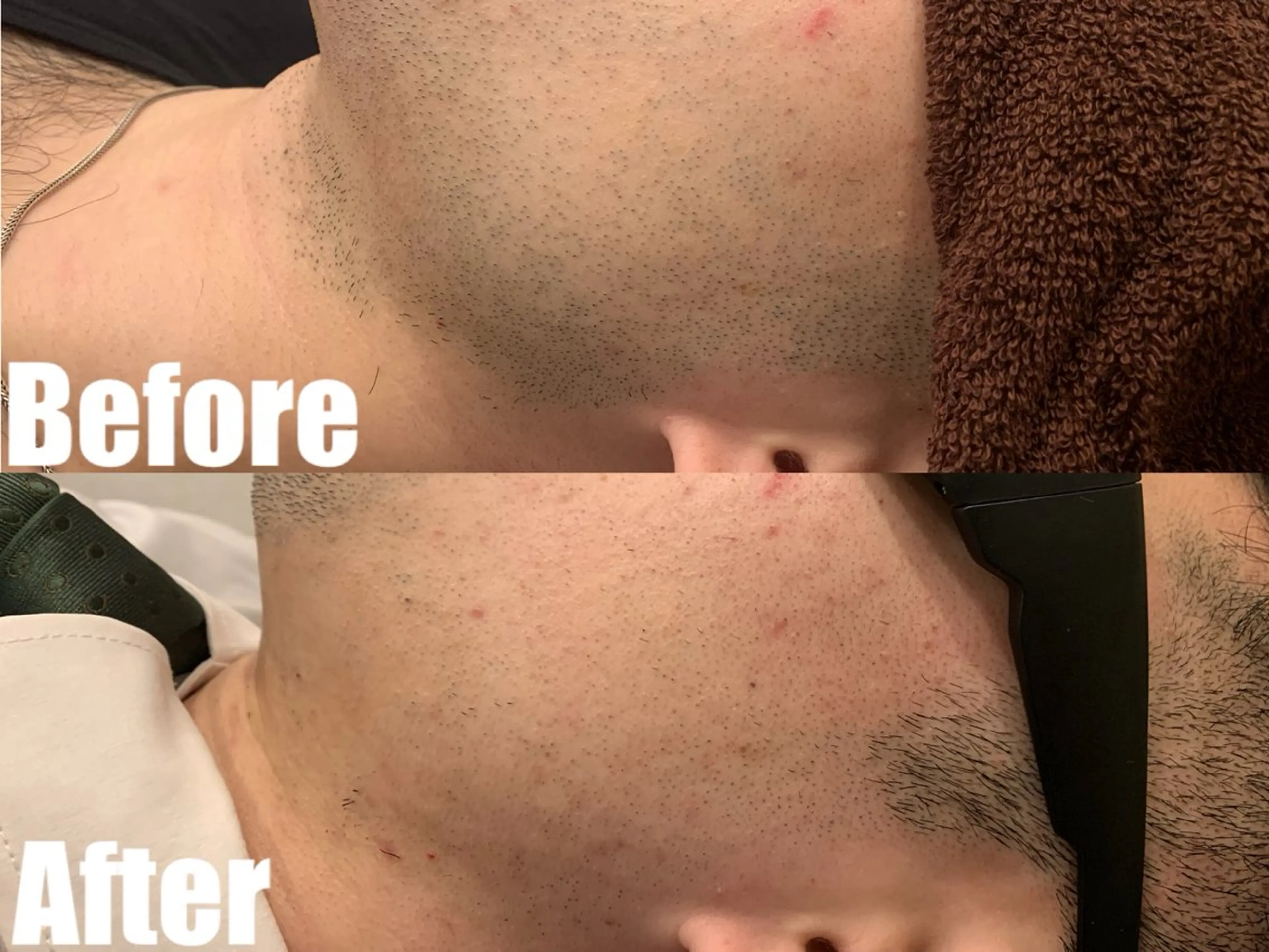 メンズ 都度払い脱毛ブレア /代々木のエステ・リラクイメージ