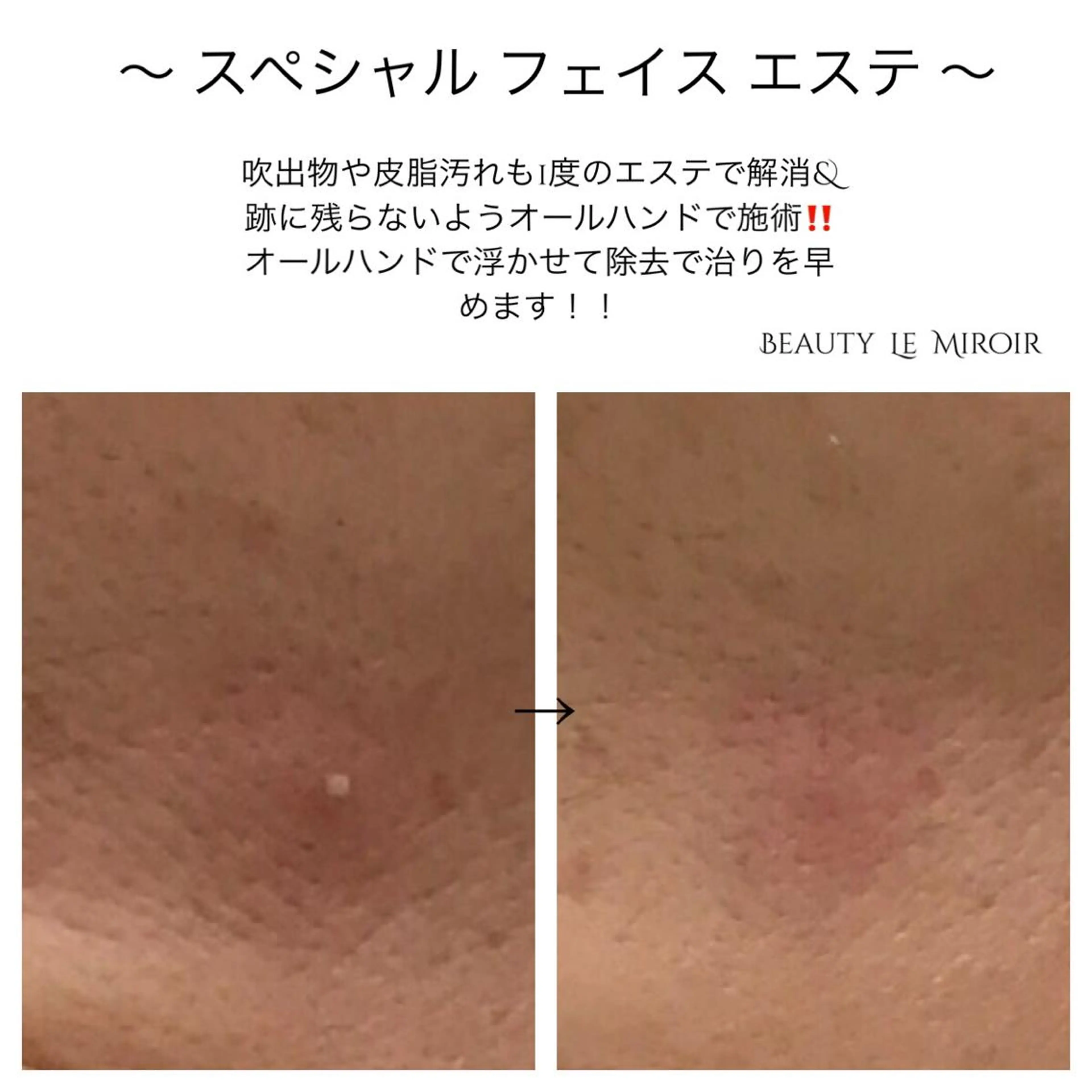 ビューティー ミロワールのエステ・リラクイメージ