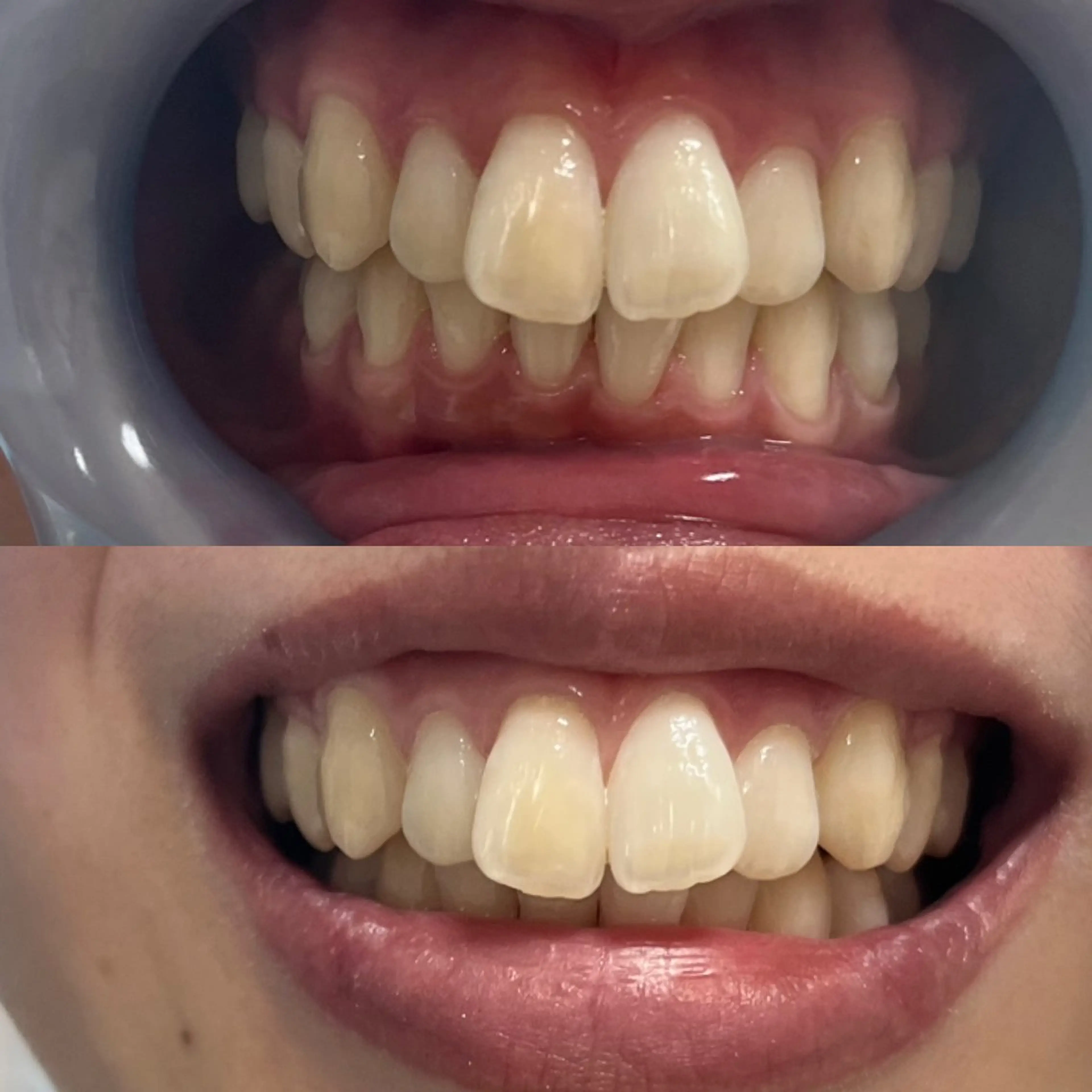 その他 Lyf salon.のエステ・リラクイメージ