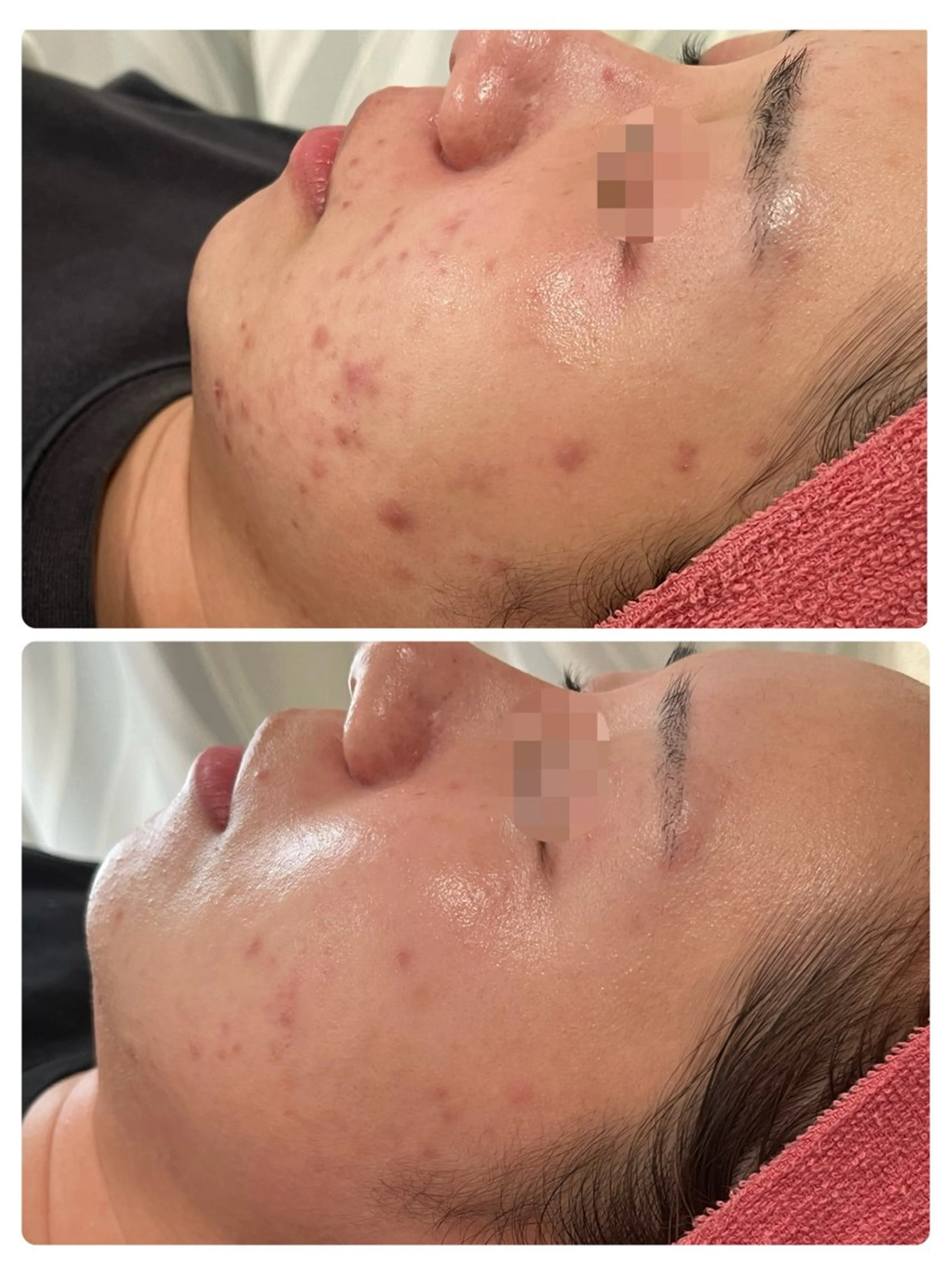 エステ Dione 立川店のエステ・リラクイメージ