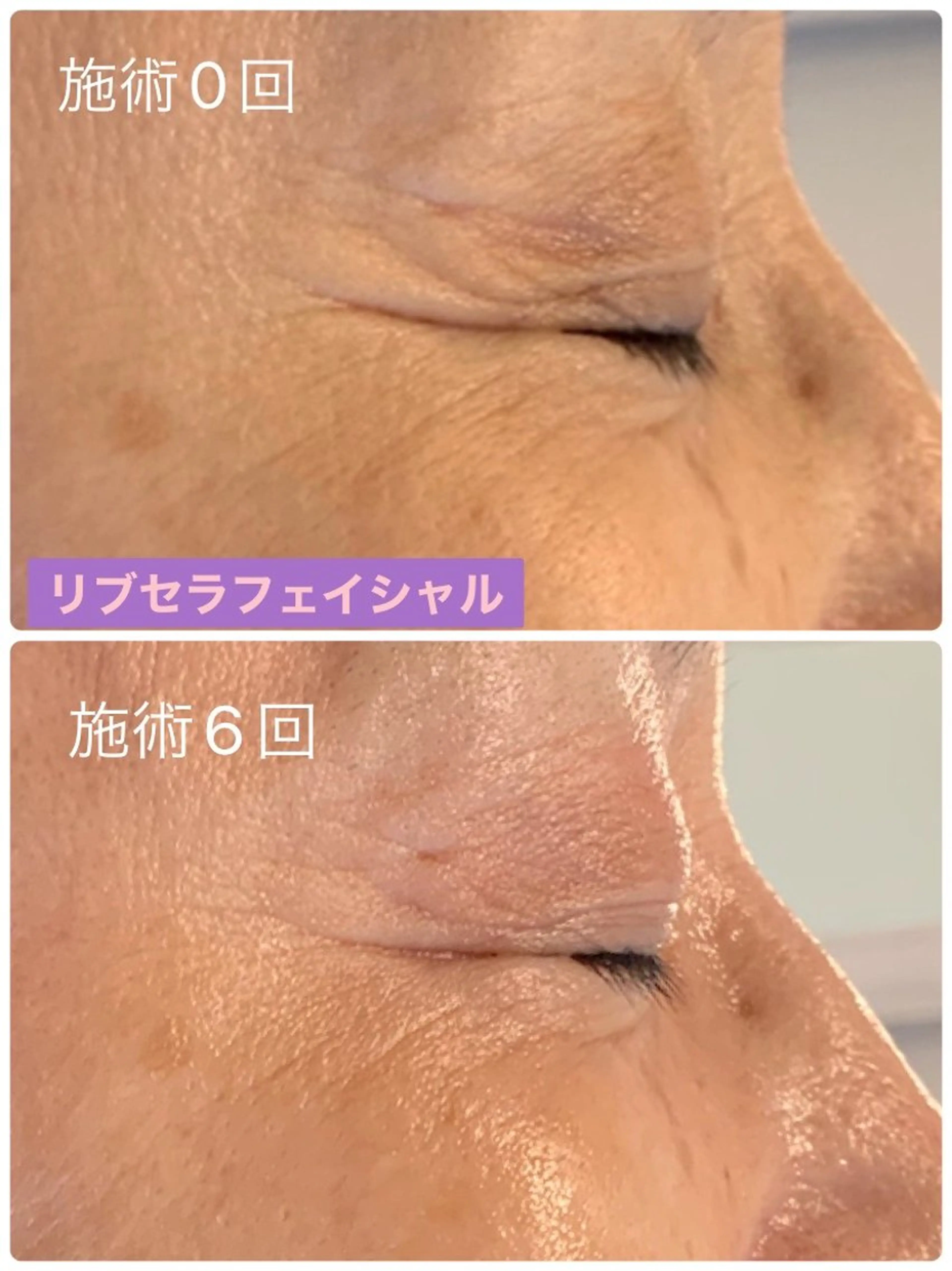 エステ プライベートサロン プリュネルのエステ・リラクイメージ