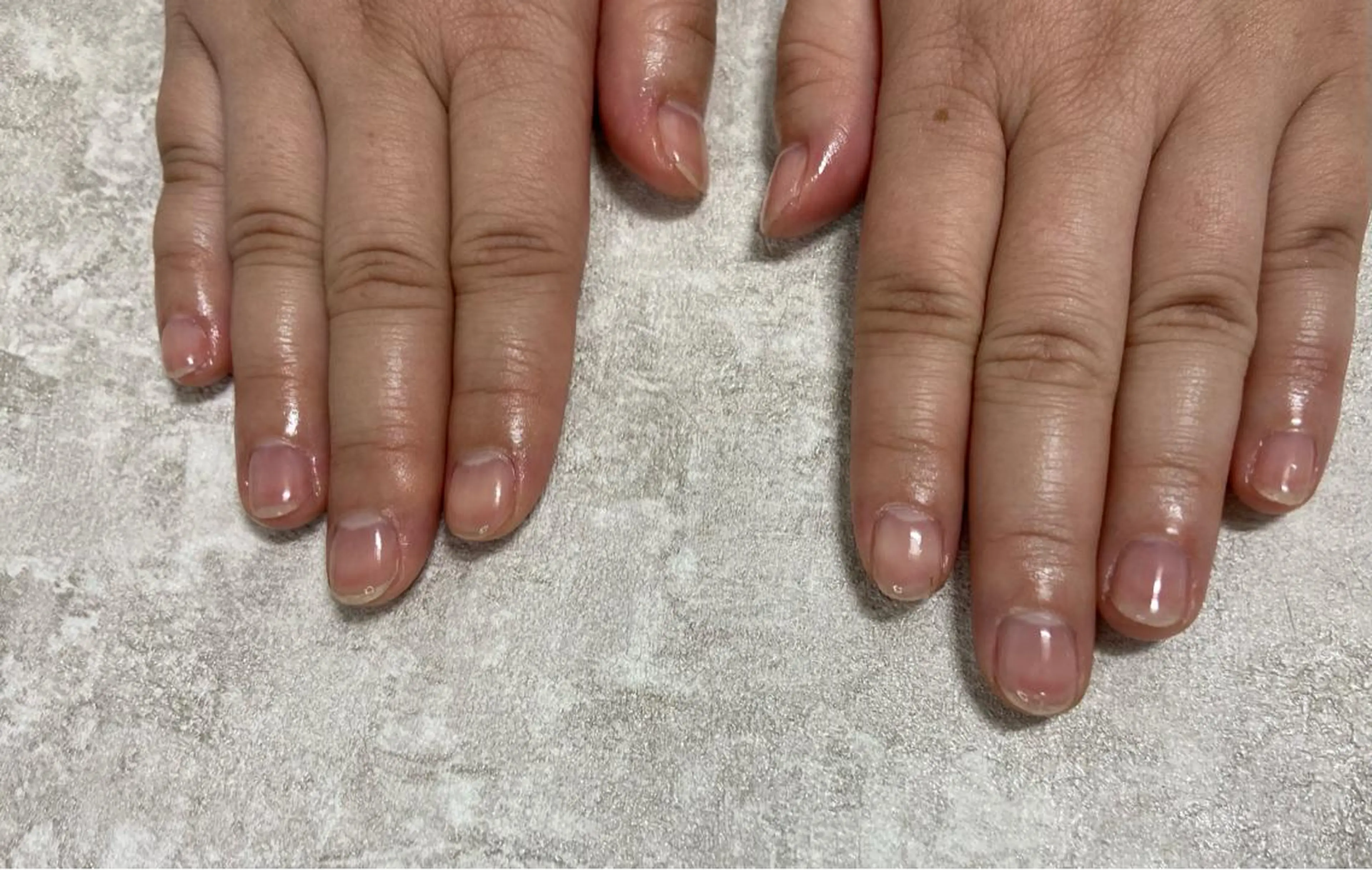 ハンドケアのみ（甘皮処理、お爪カット、ファイリング）の写真