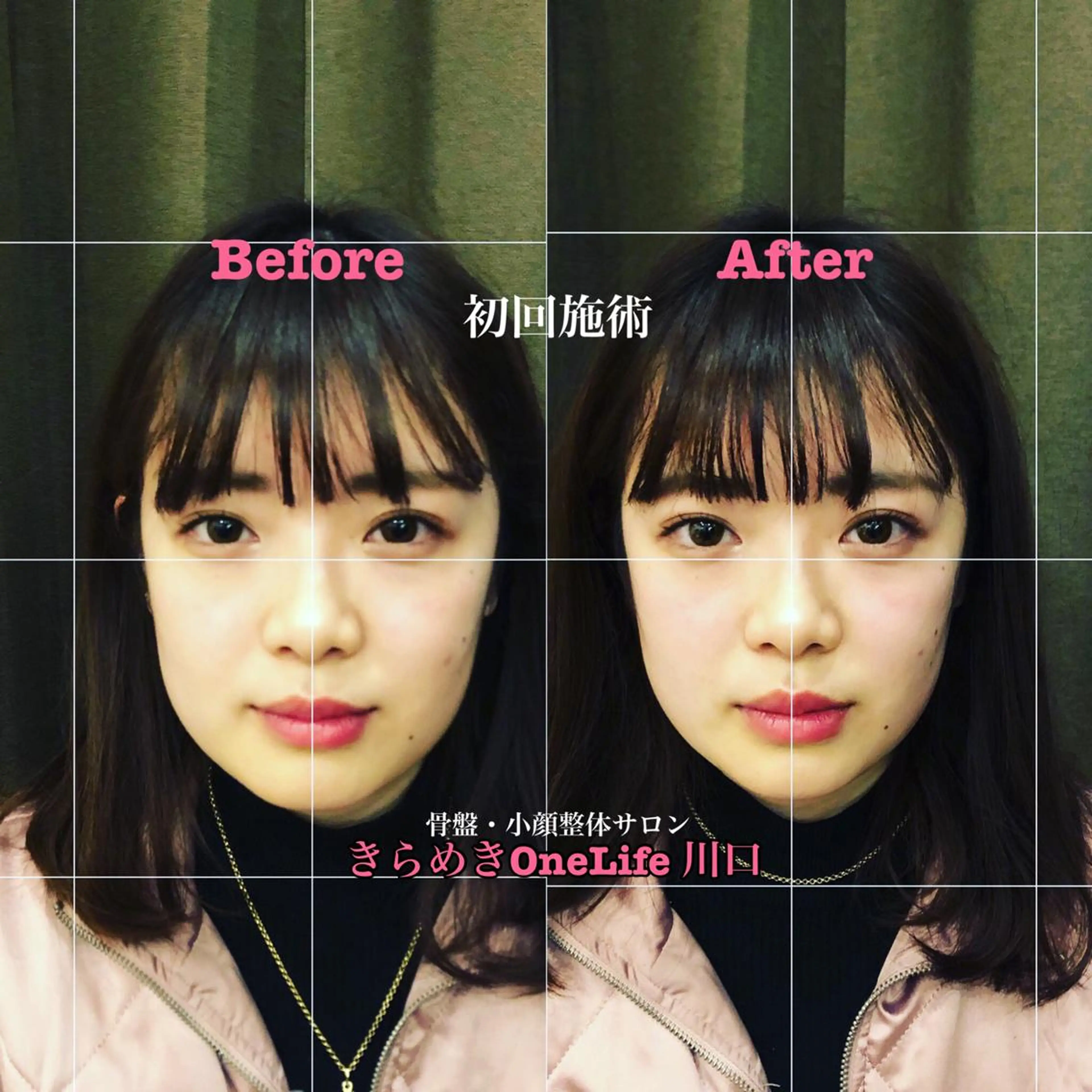 エステ リラク きらめきワンライフ Yumaのエステ・リラクイメージ