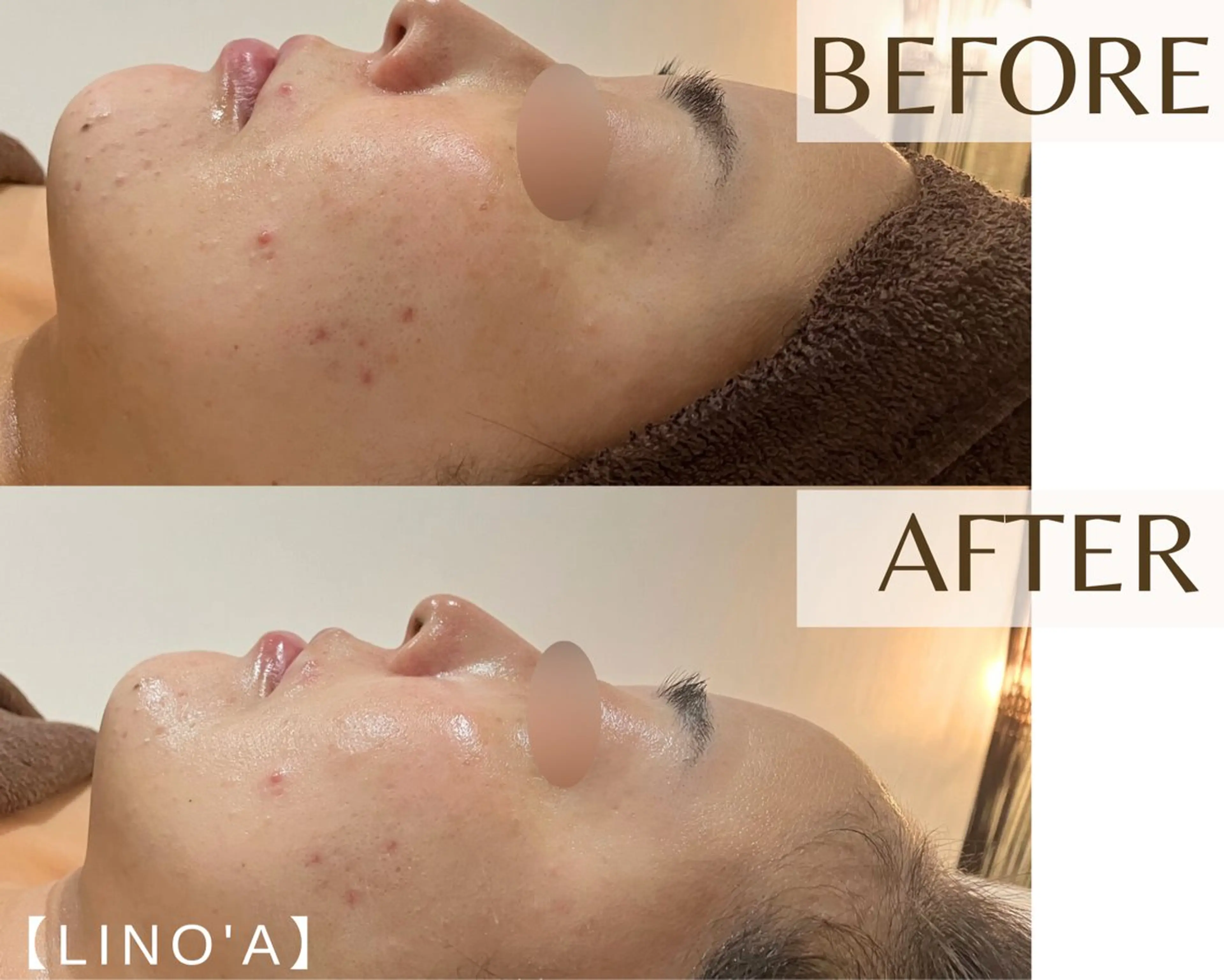 エステ リラク Salon💫 Lino'a柏店のエステ・リラクイメージ