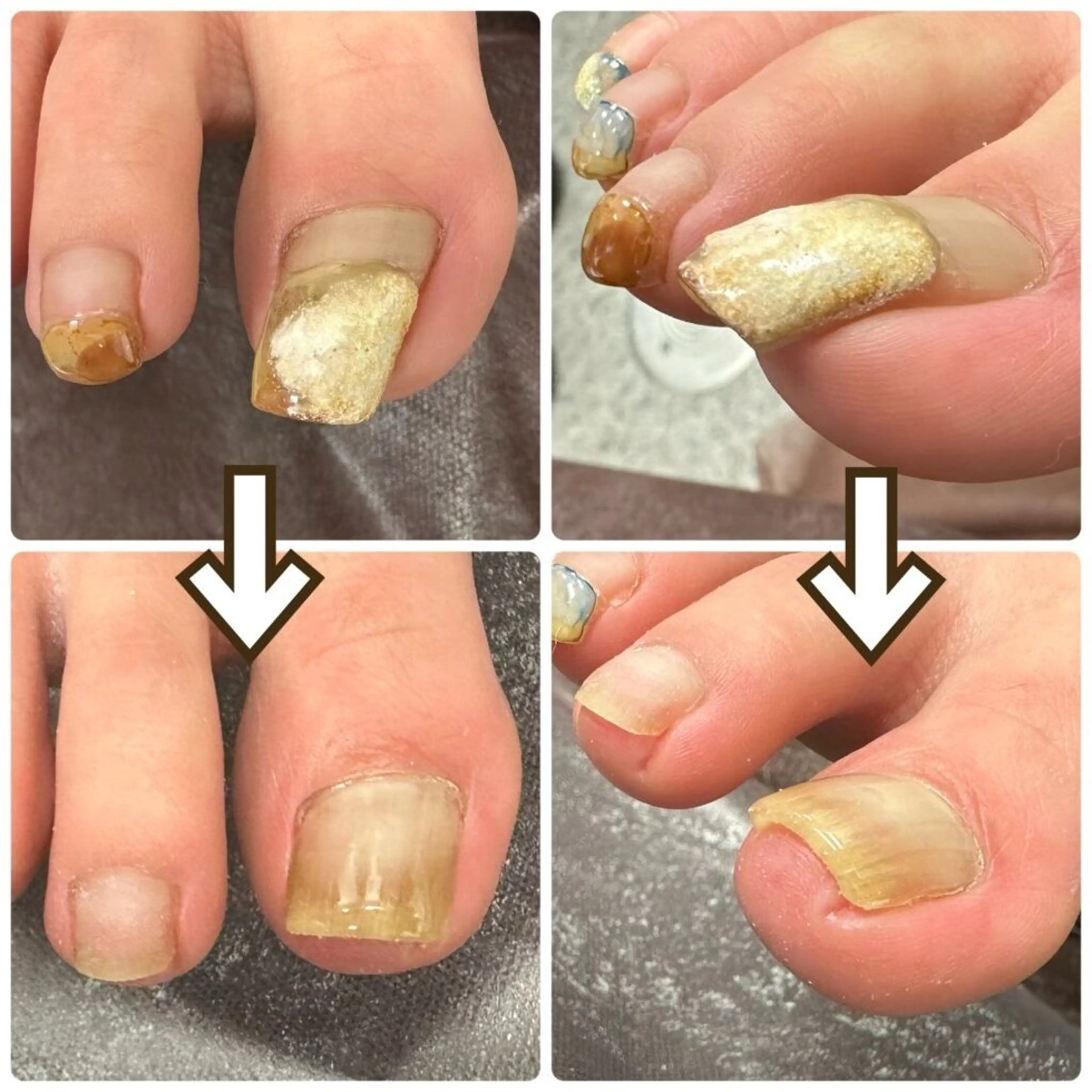 ネイル フットネイル フットネイル Nail Salon Orangeのネイルデザイン