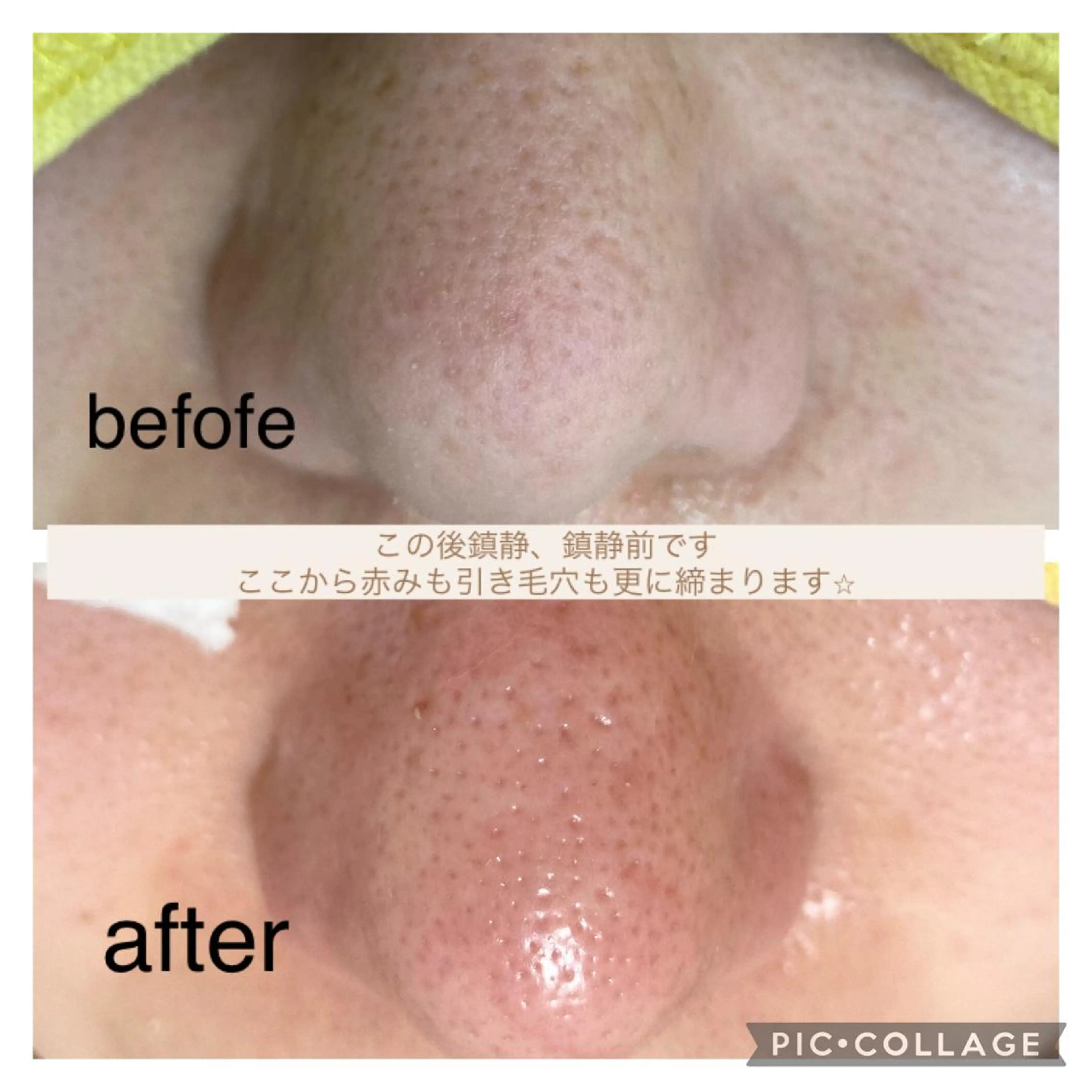 エステ 毛穴ケア・肌質改善 徳川のエステ・リラクイメージ