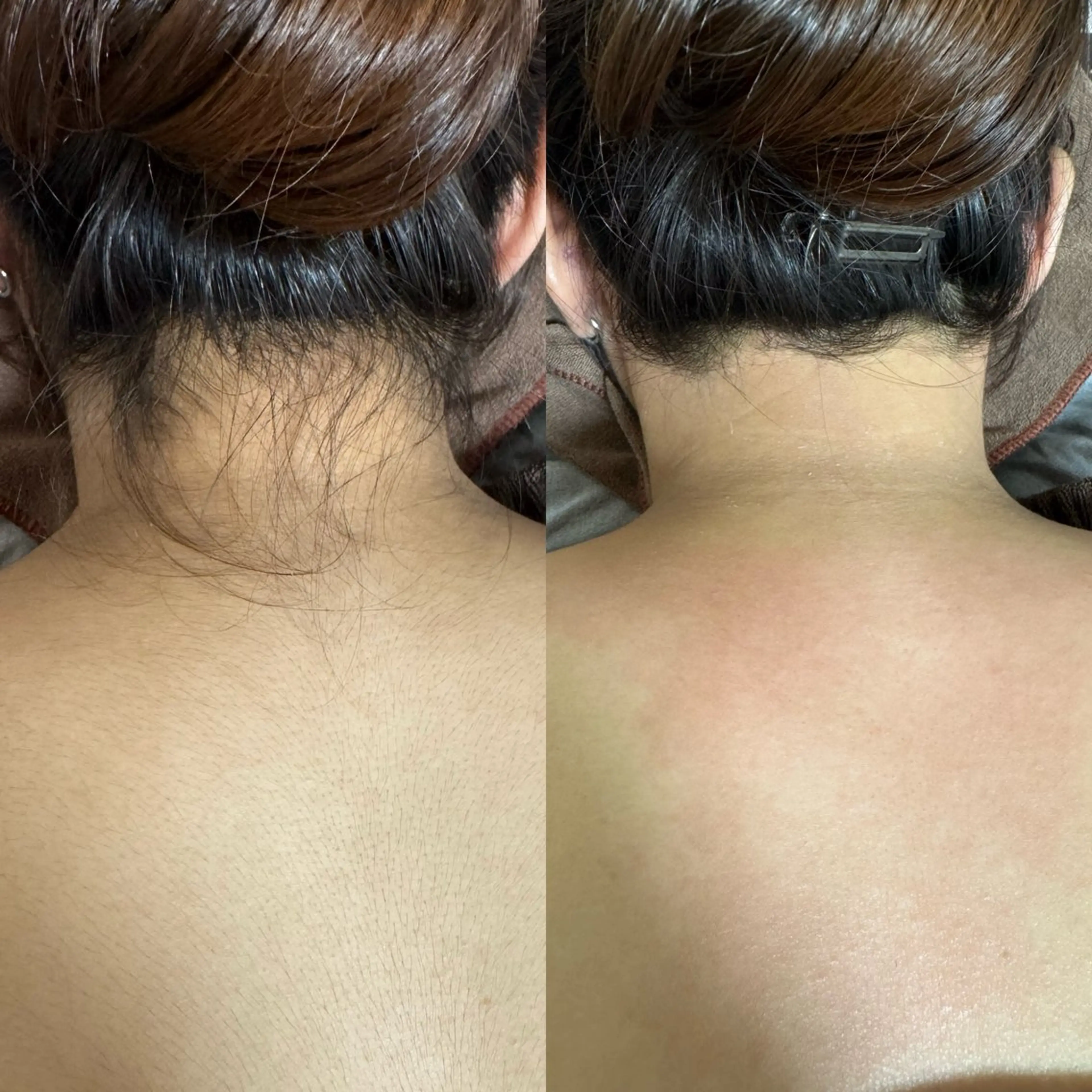 脱毛 六本木脱毛andS 店長Sachiのエステ・リラクイメージ