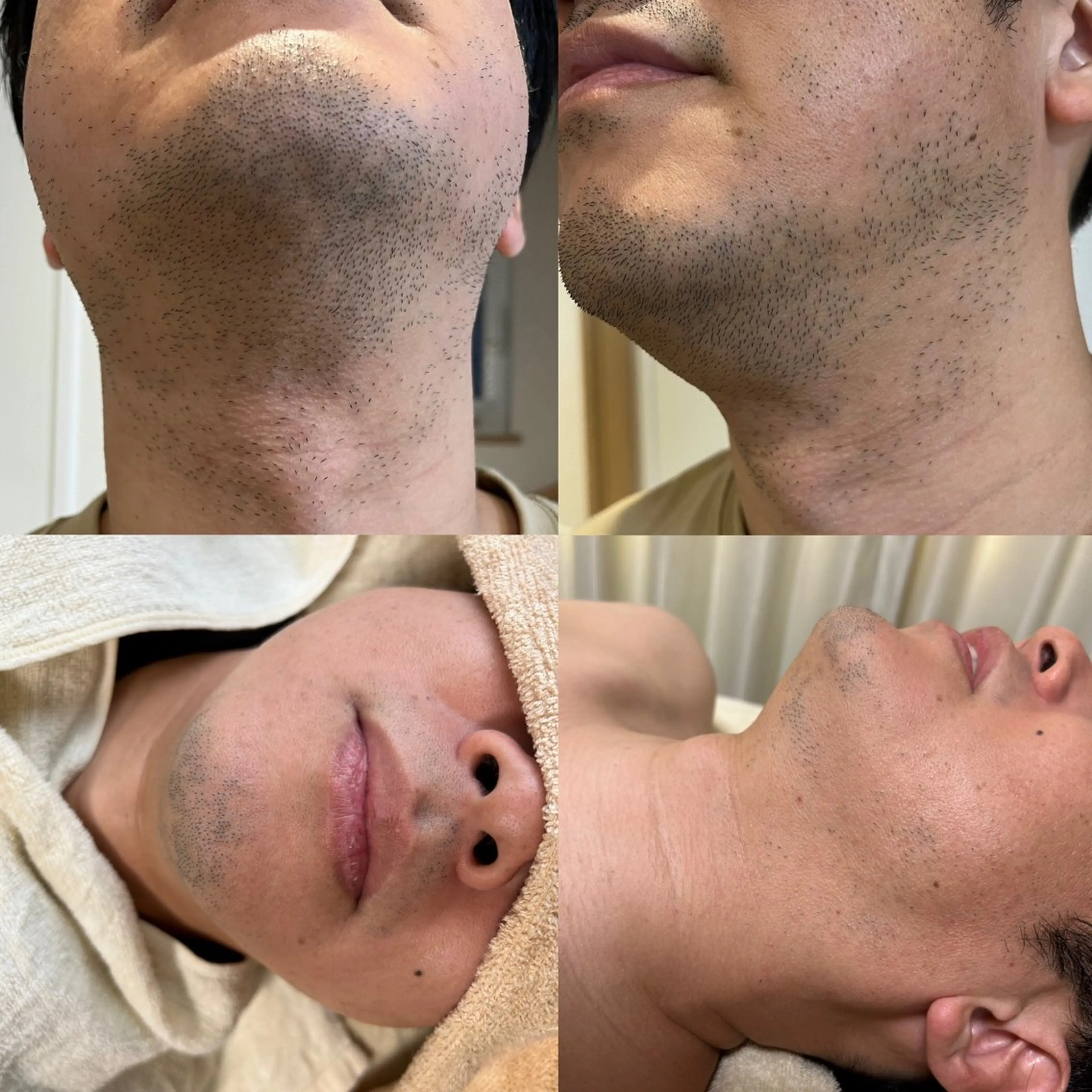 メンズ 脱毛 濱田 美菜子のエステ・リラクイメージ