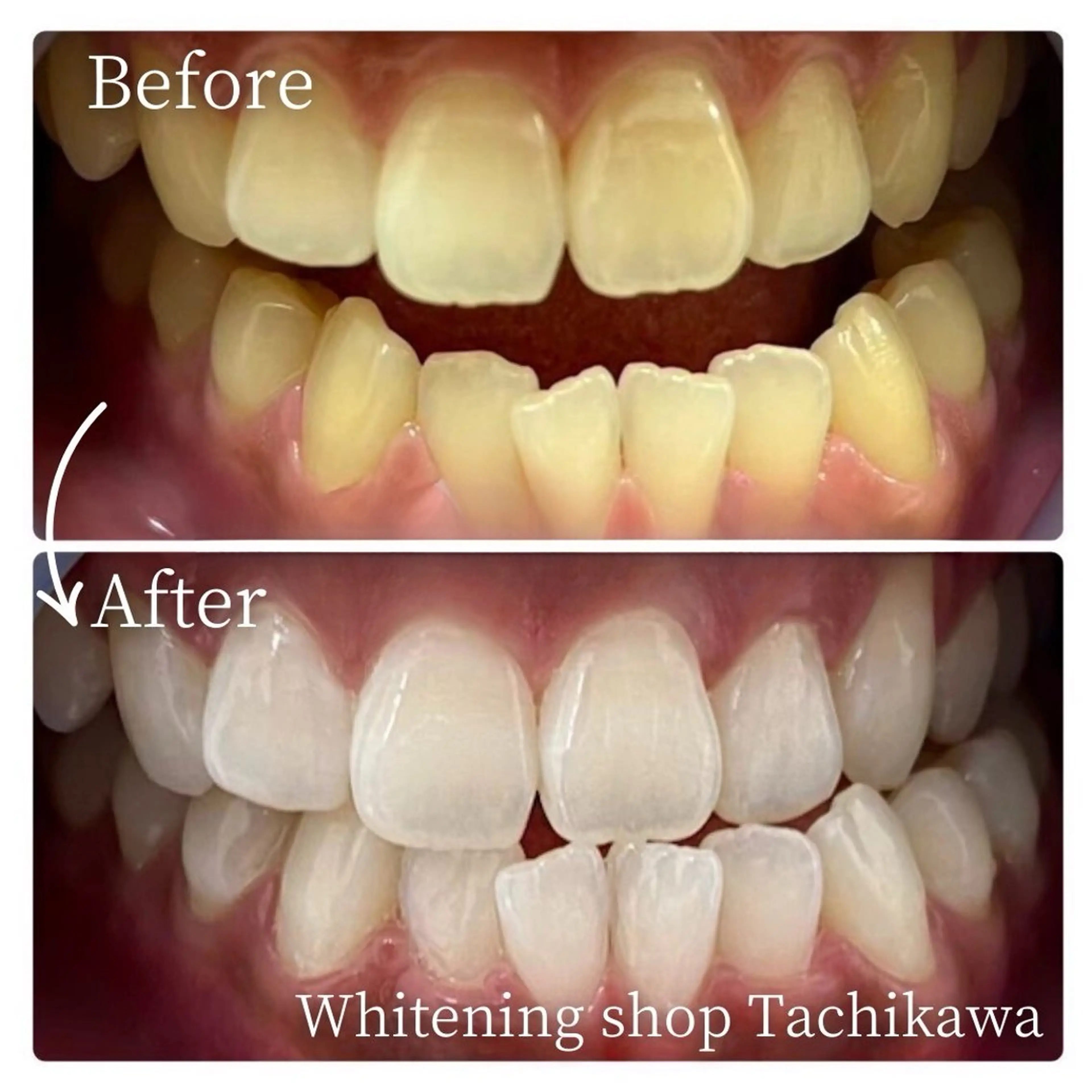 セルフ　ホワイト ニングショップ立川のその他イメージ