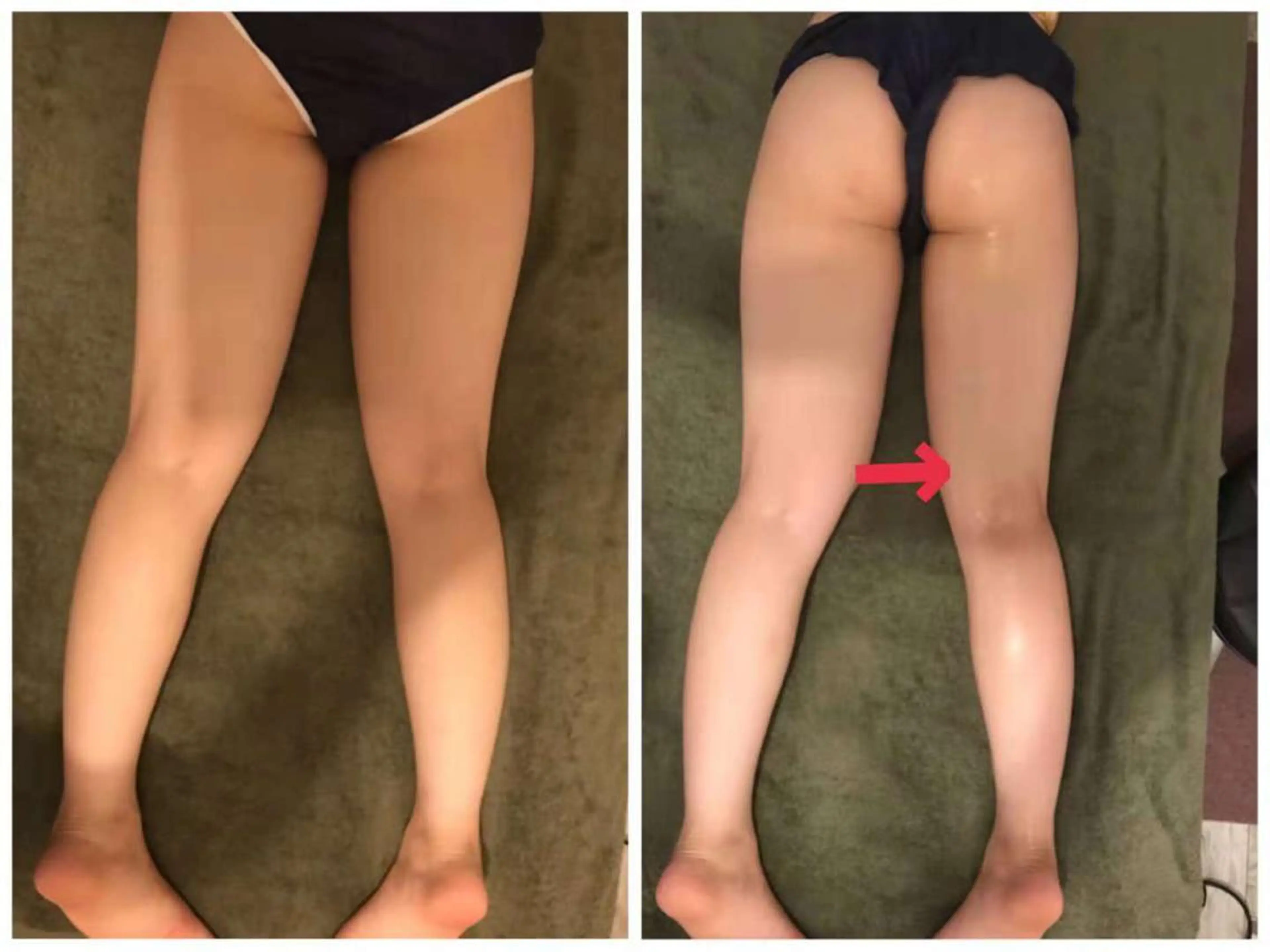 【むくみスッキリ美脚へ✨】ホットストーン付💕膝周り＆ふくらはぎリンパ＋足裏60分の写真