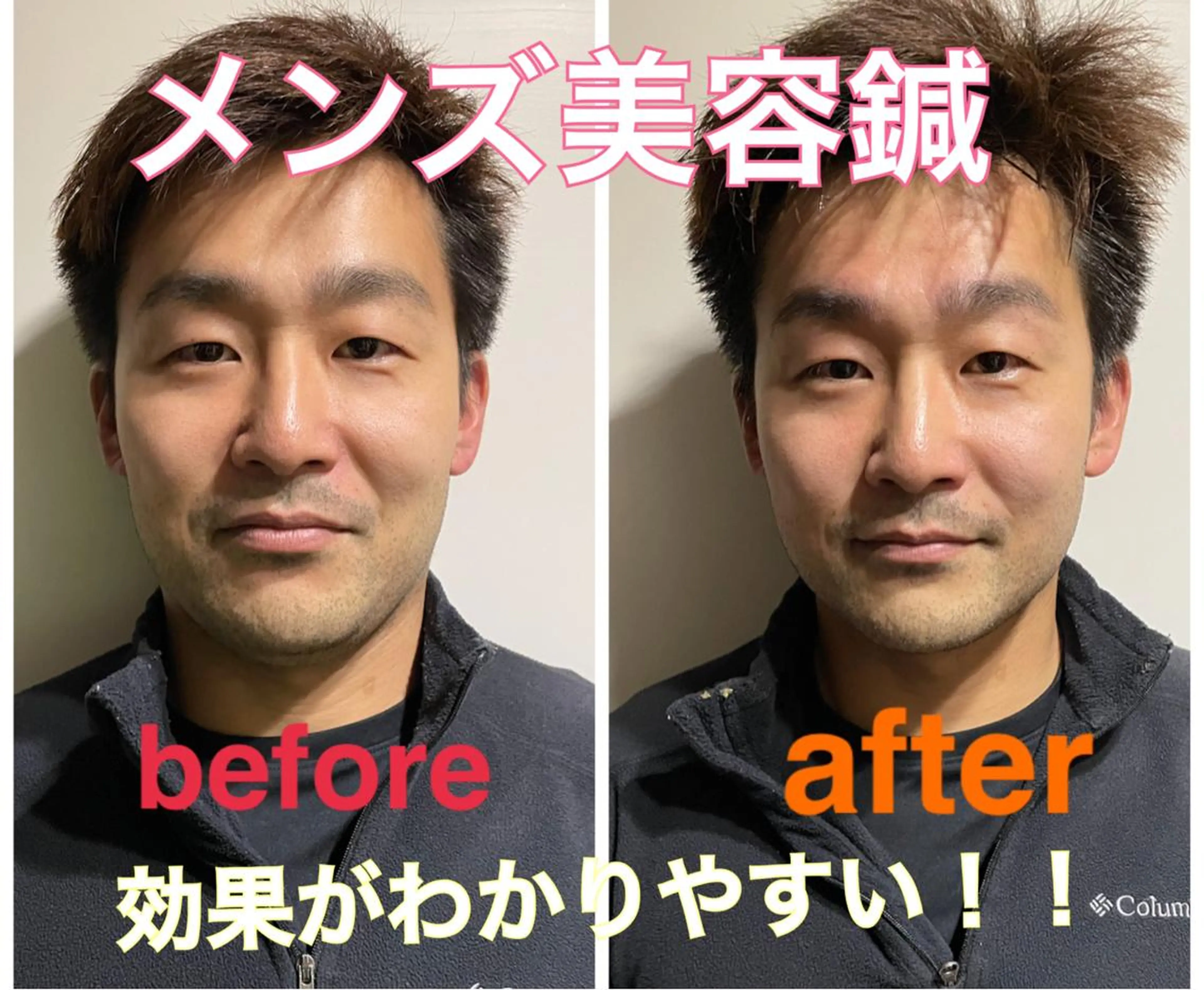 美容鍼灸サロン mahoroba院長のエステ・リラクイメージ