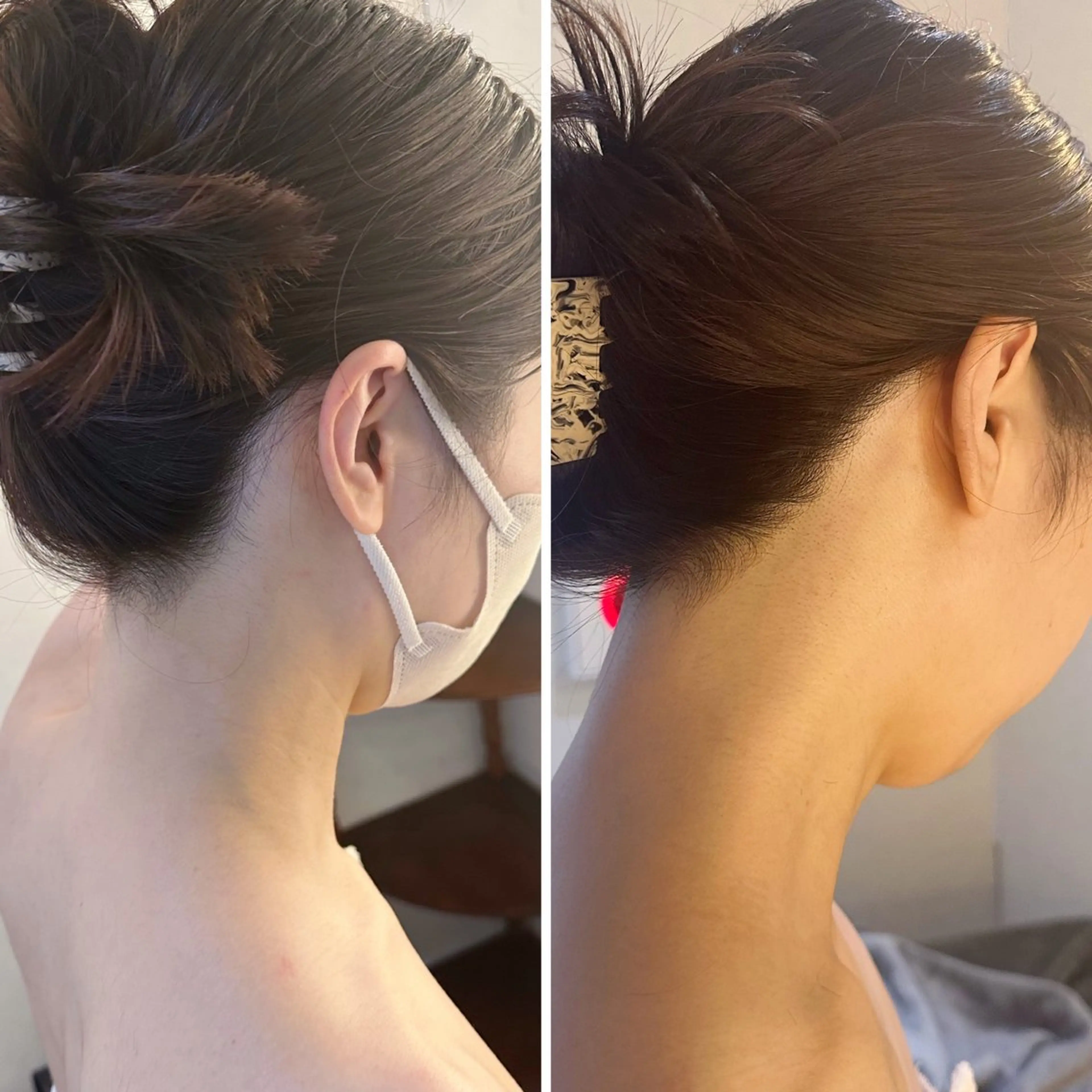 脱毛 うなじ脱毛/美肌脱毛 LABELのエステ・リラクイメージ