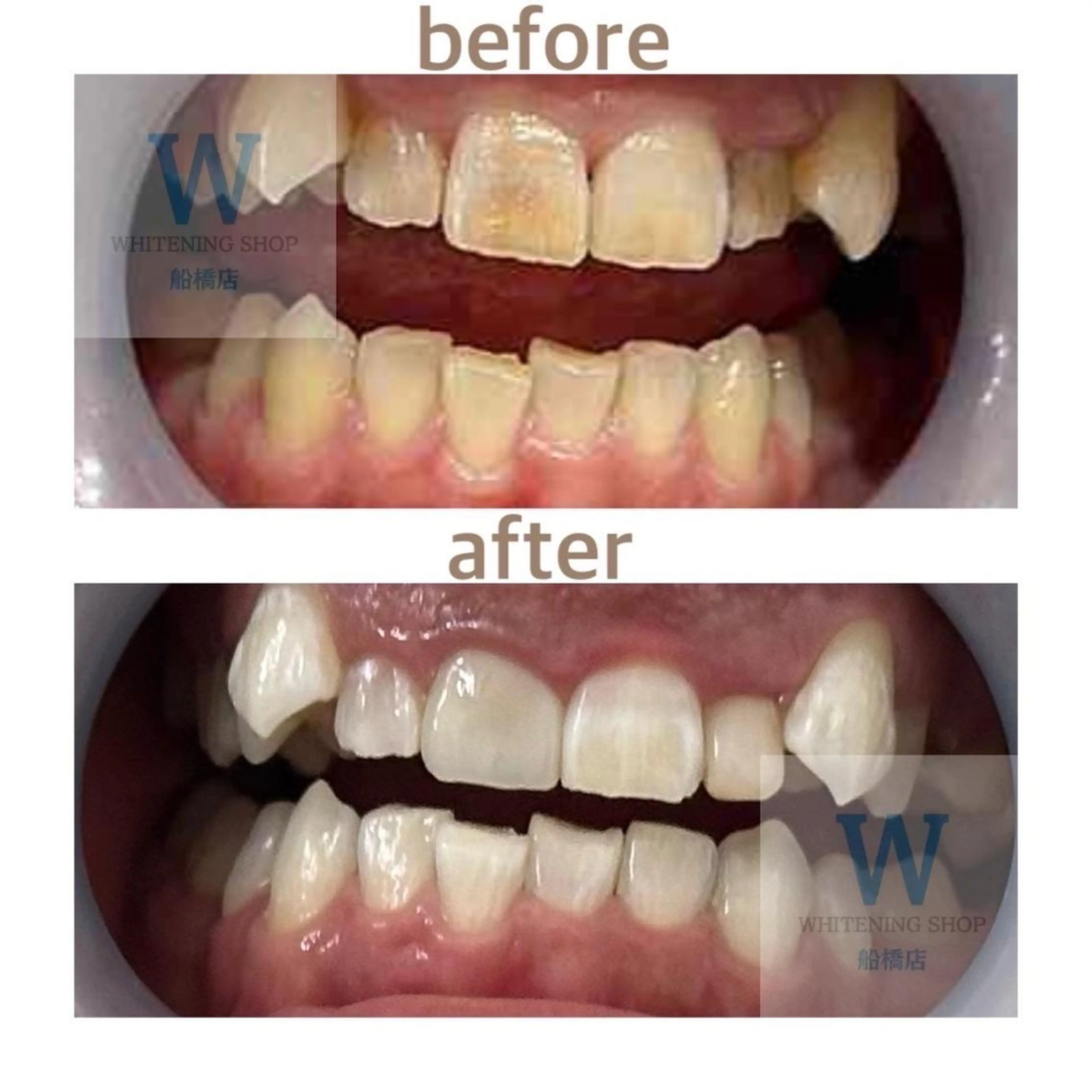 エステ リラク ホワイトニング ショップ船橋店🦷のエステ・リラクイメージ