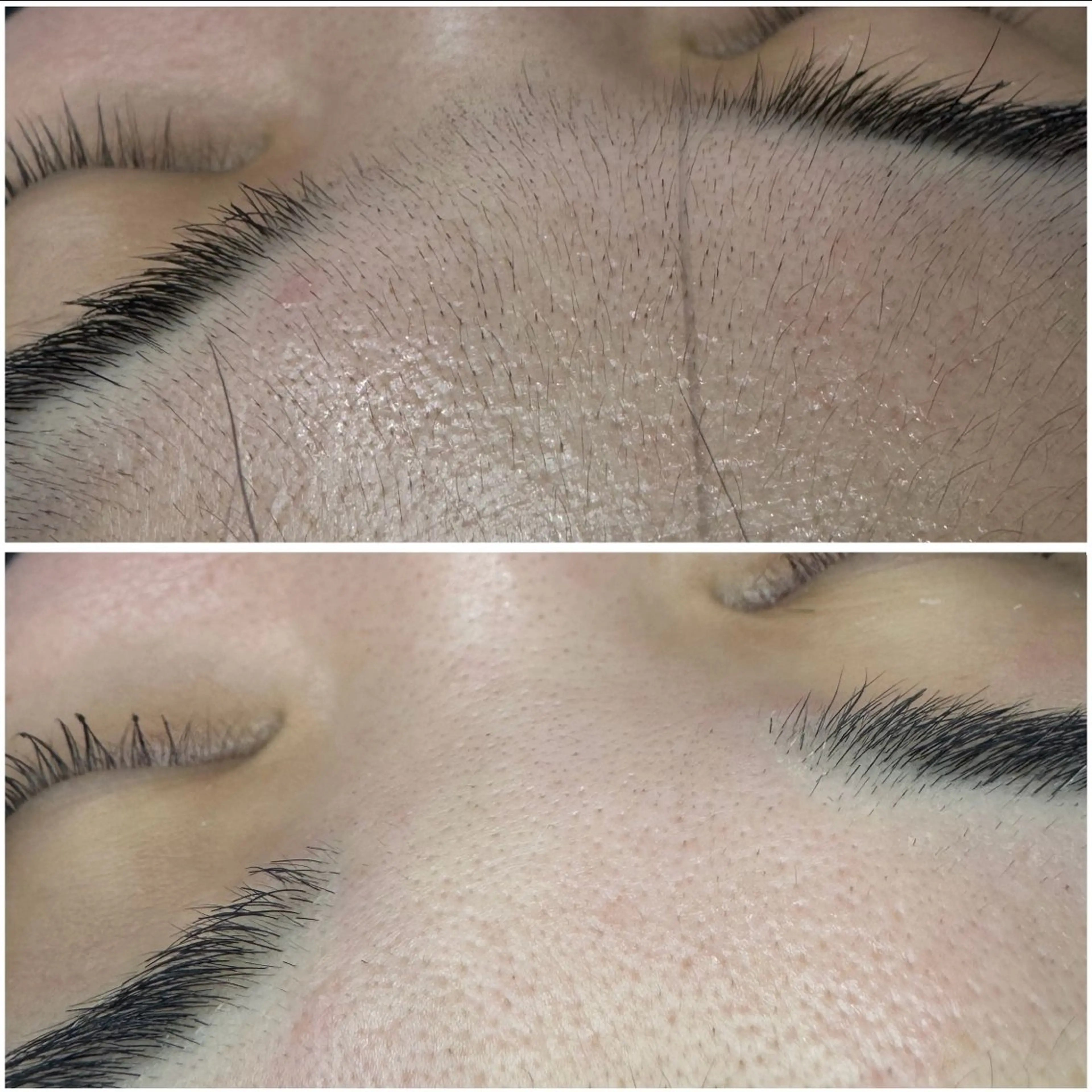 アイブロウ 眉毛ワックス脱毛 ワックス脱毛 Aime'e所属・野田 美早のマツエク・マツパデザイン