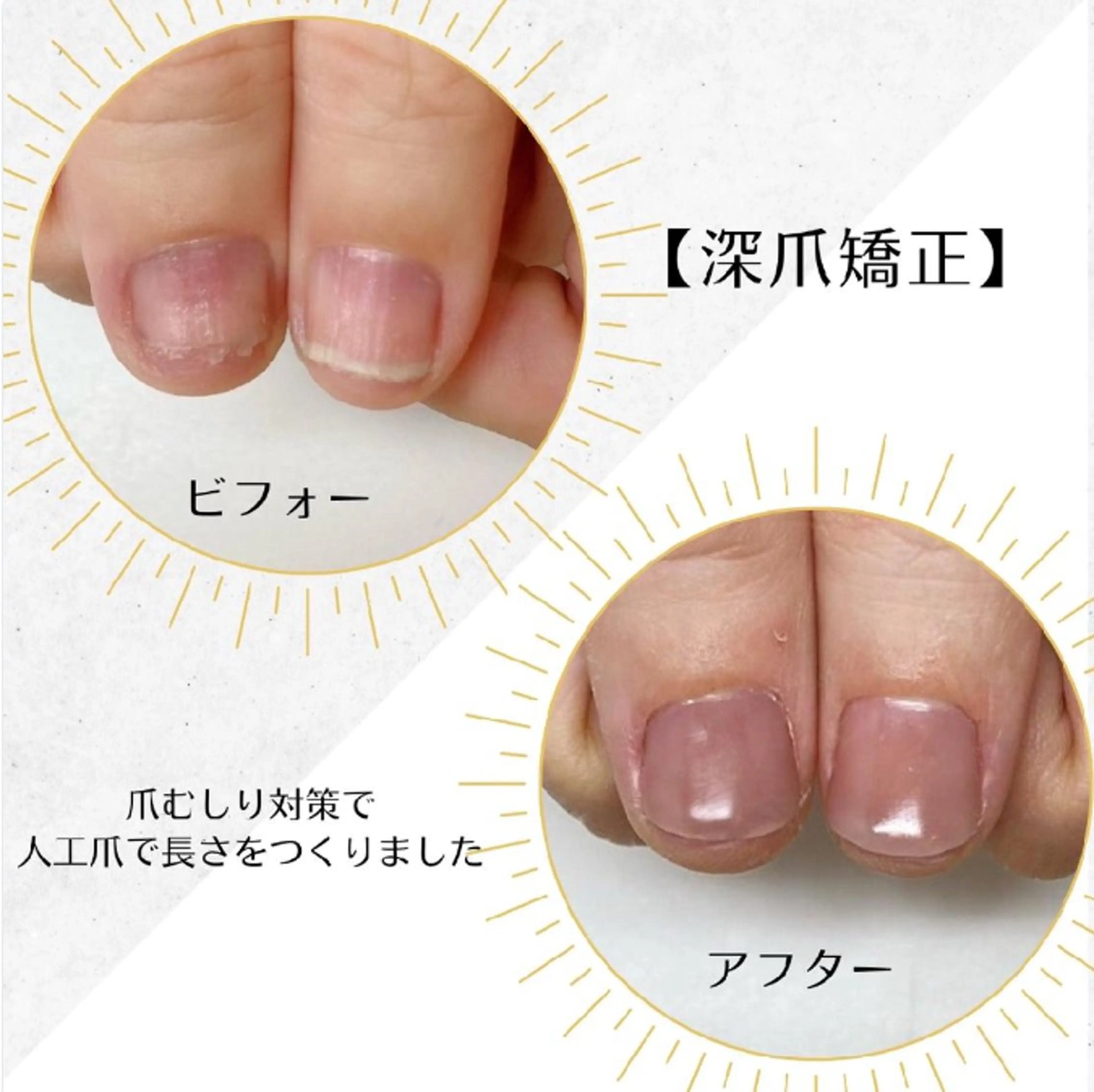 ネイル ネイルサロン アリュームのネイルデザイン