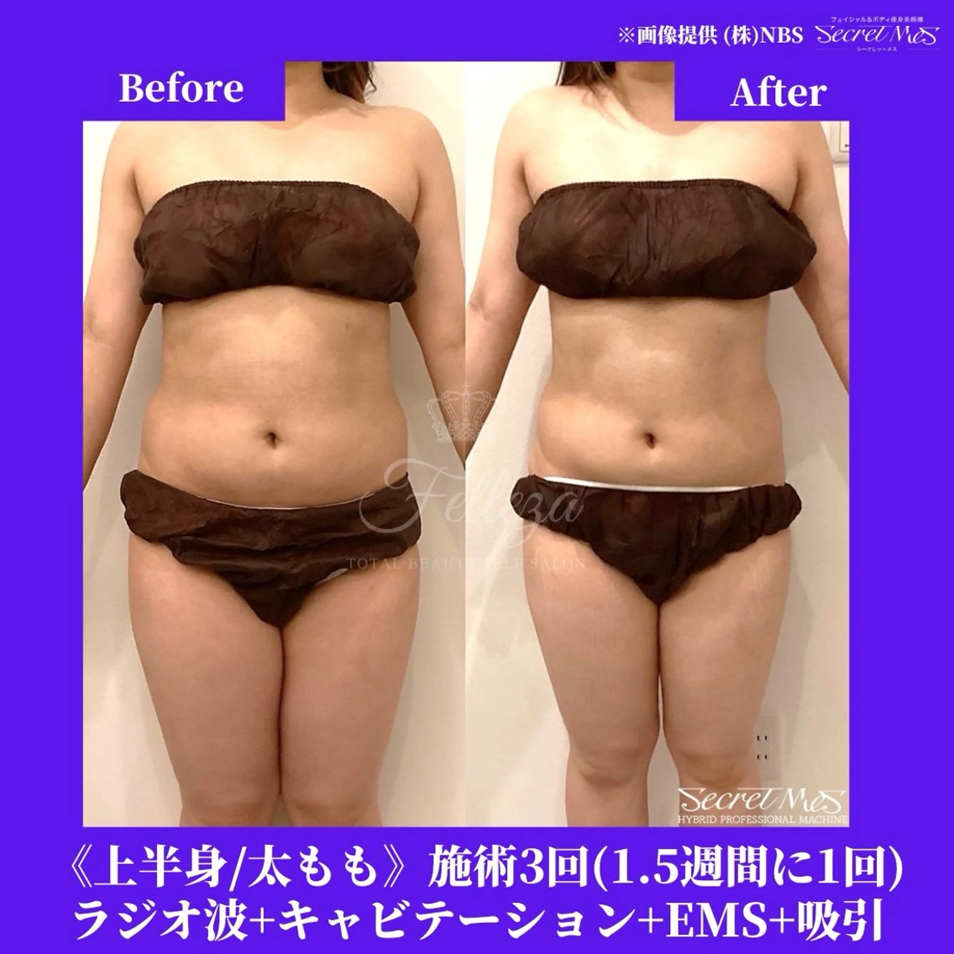 メンズ 有人型セルフサロン 脱毛／痩身／美顔のエステ・リラクイメージ