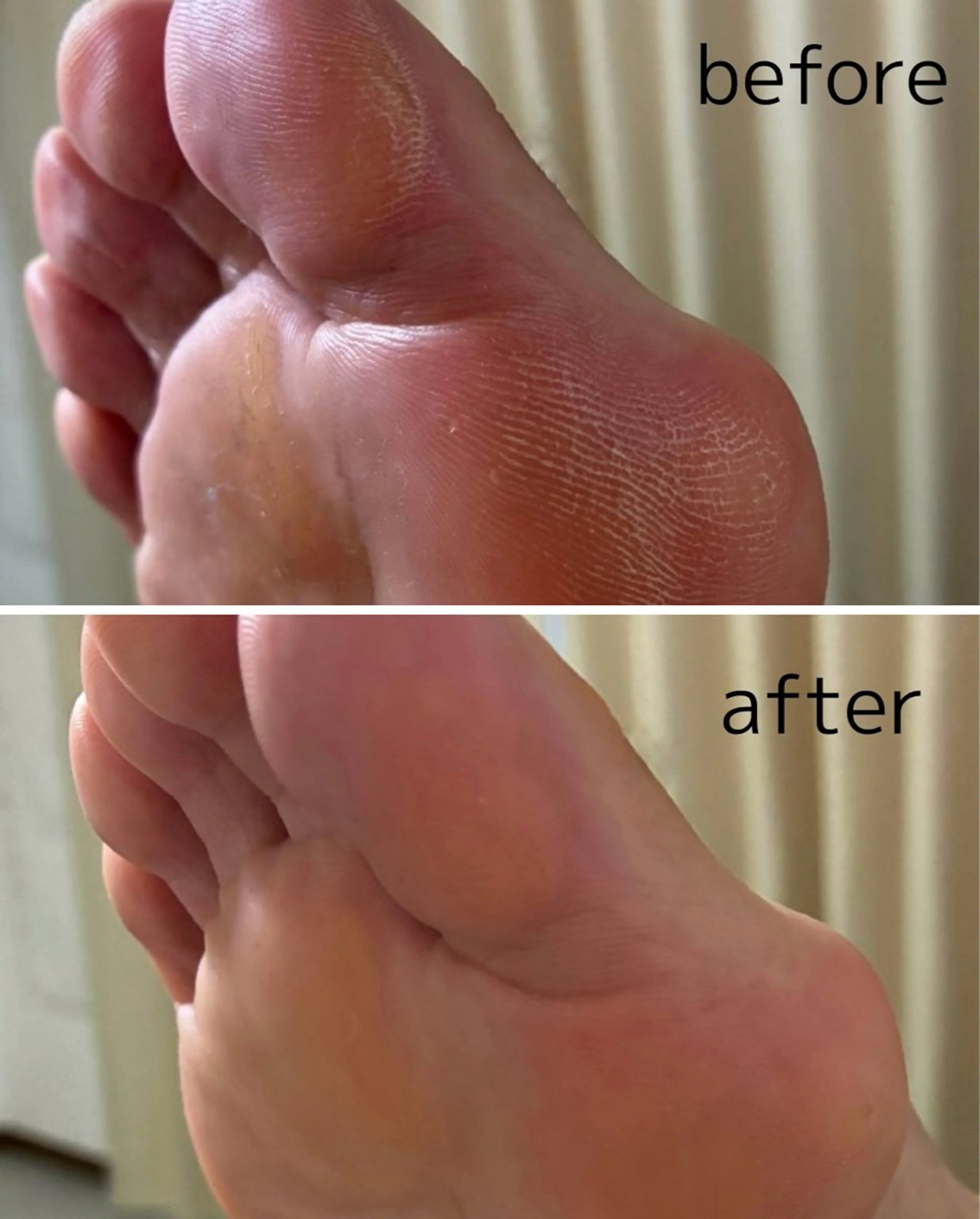 Li.m nail リム ネイルのネイルデザイン