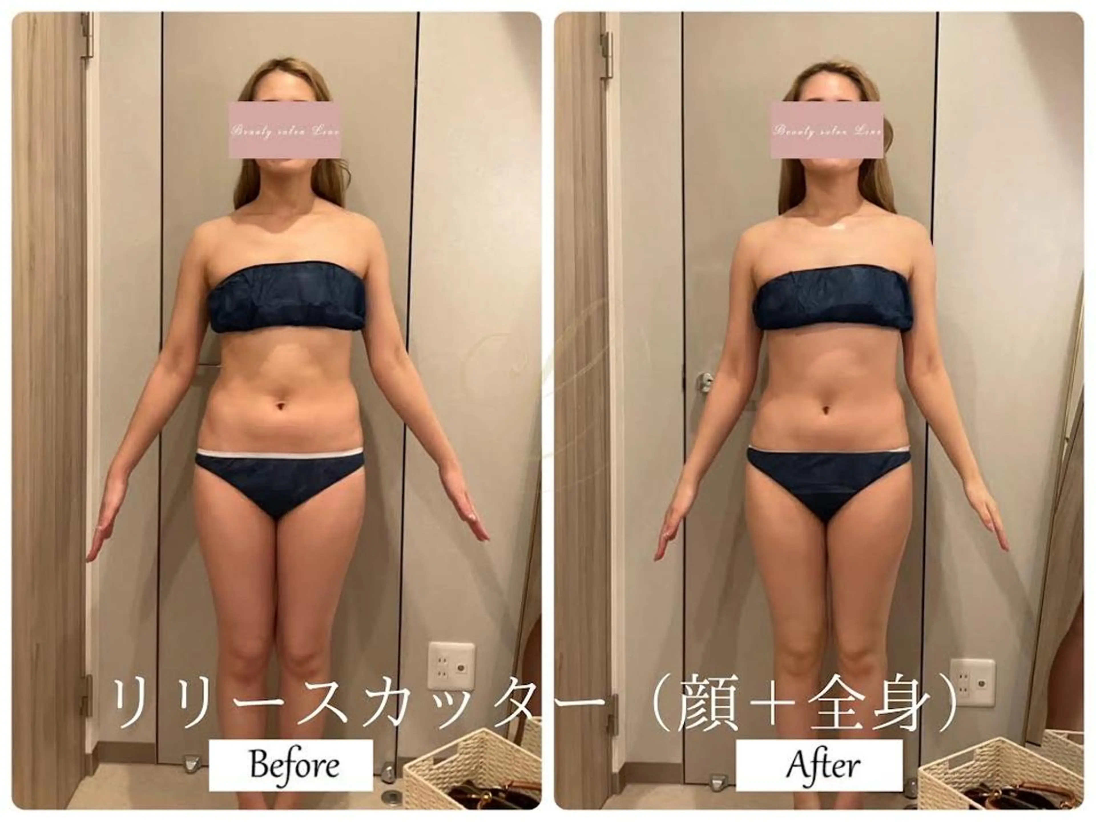 エステ リラク ブライダルサロン ｜Lino【堀江】のエステ・リラクイメージ