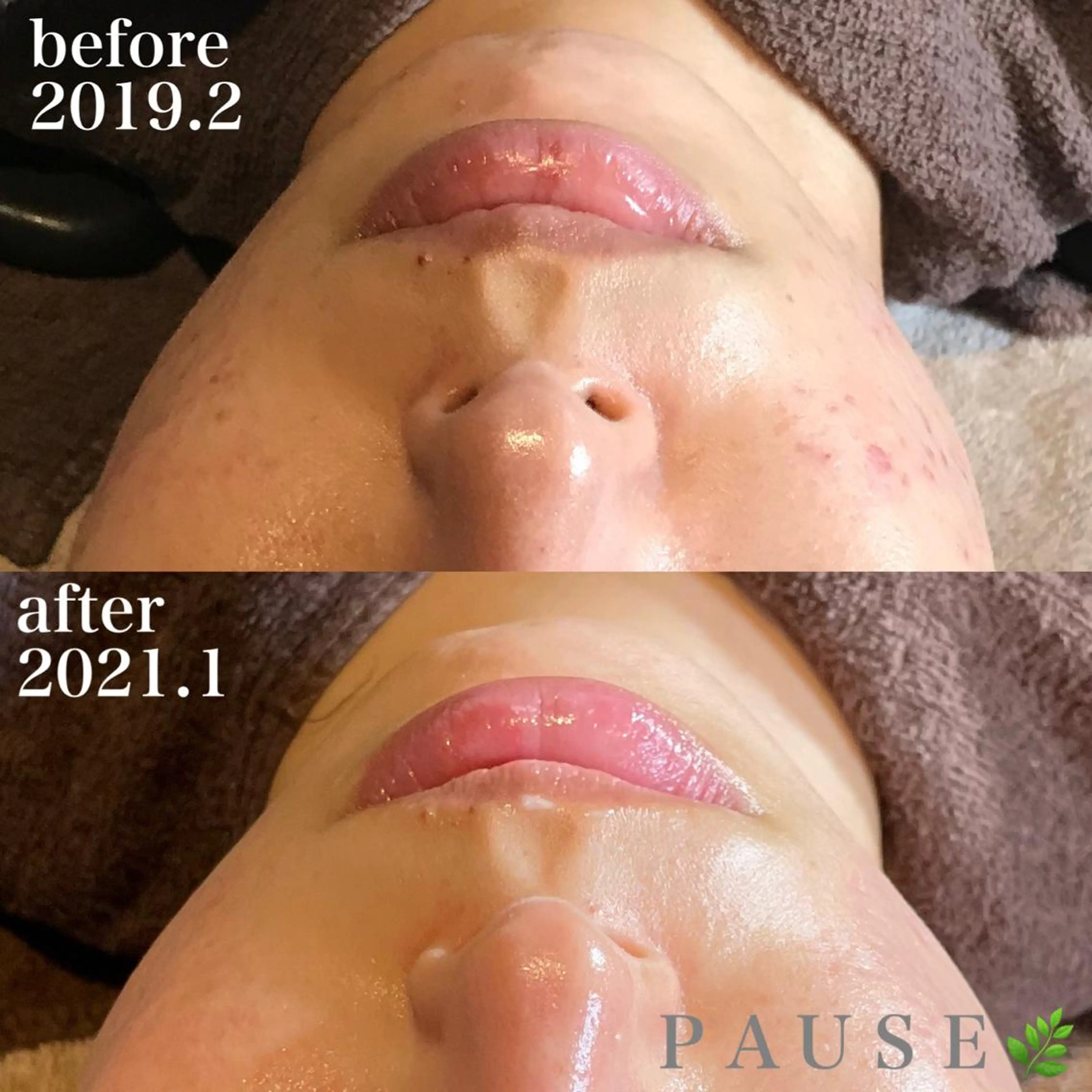 エステ 浜野 恵美のエステ・リラクイメージ