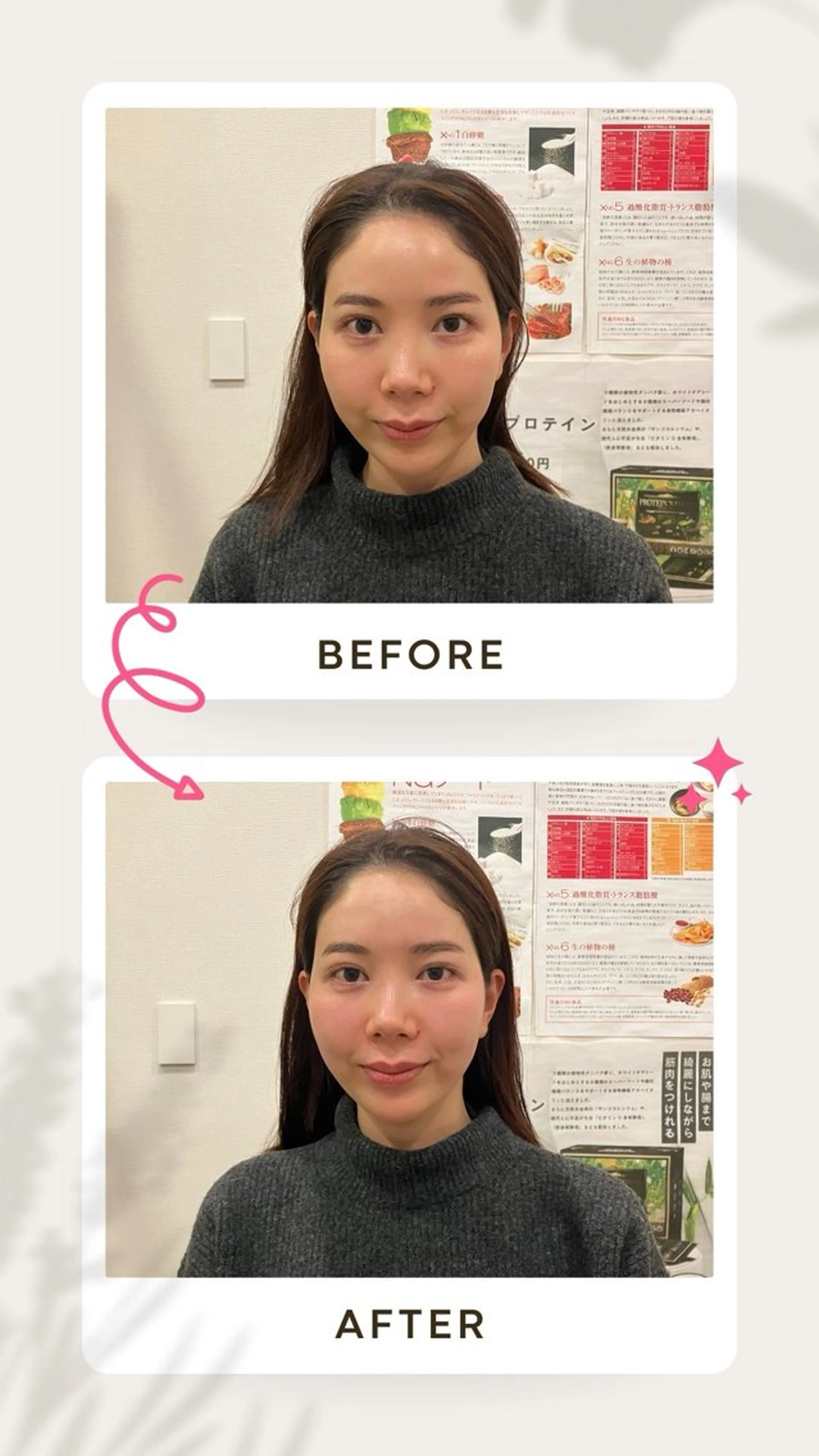 健康×美容鍼鍼灸院 あさば整体院三ノ輪店のエステ・リラクイメージ