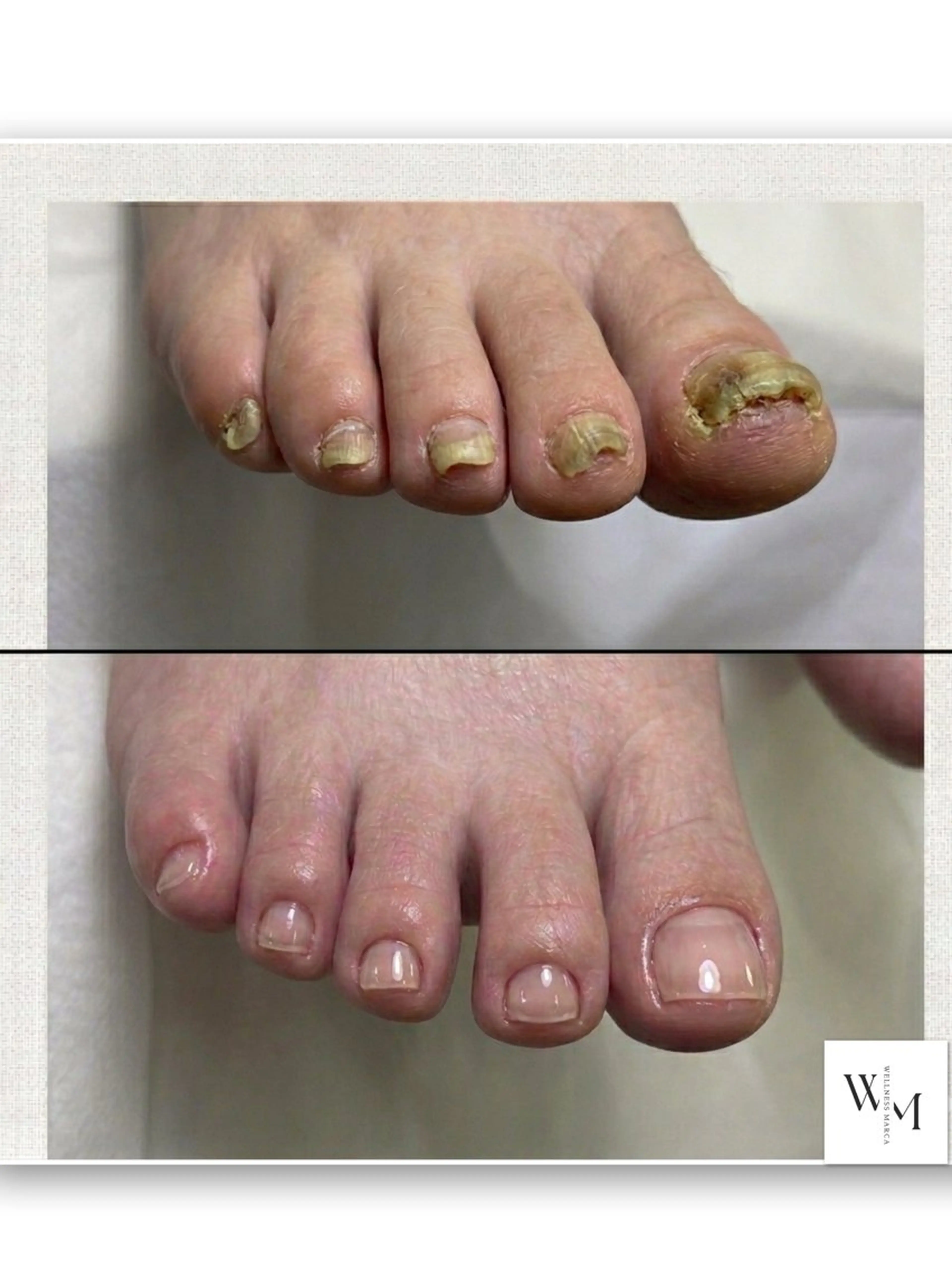 ネイル フットネイル ジェルネイル フットネイル 【メンズサロン】 MARCAのネイルデザイン